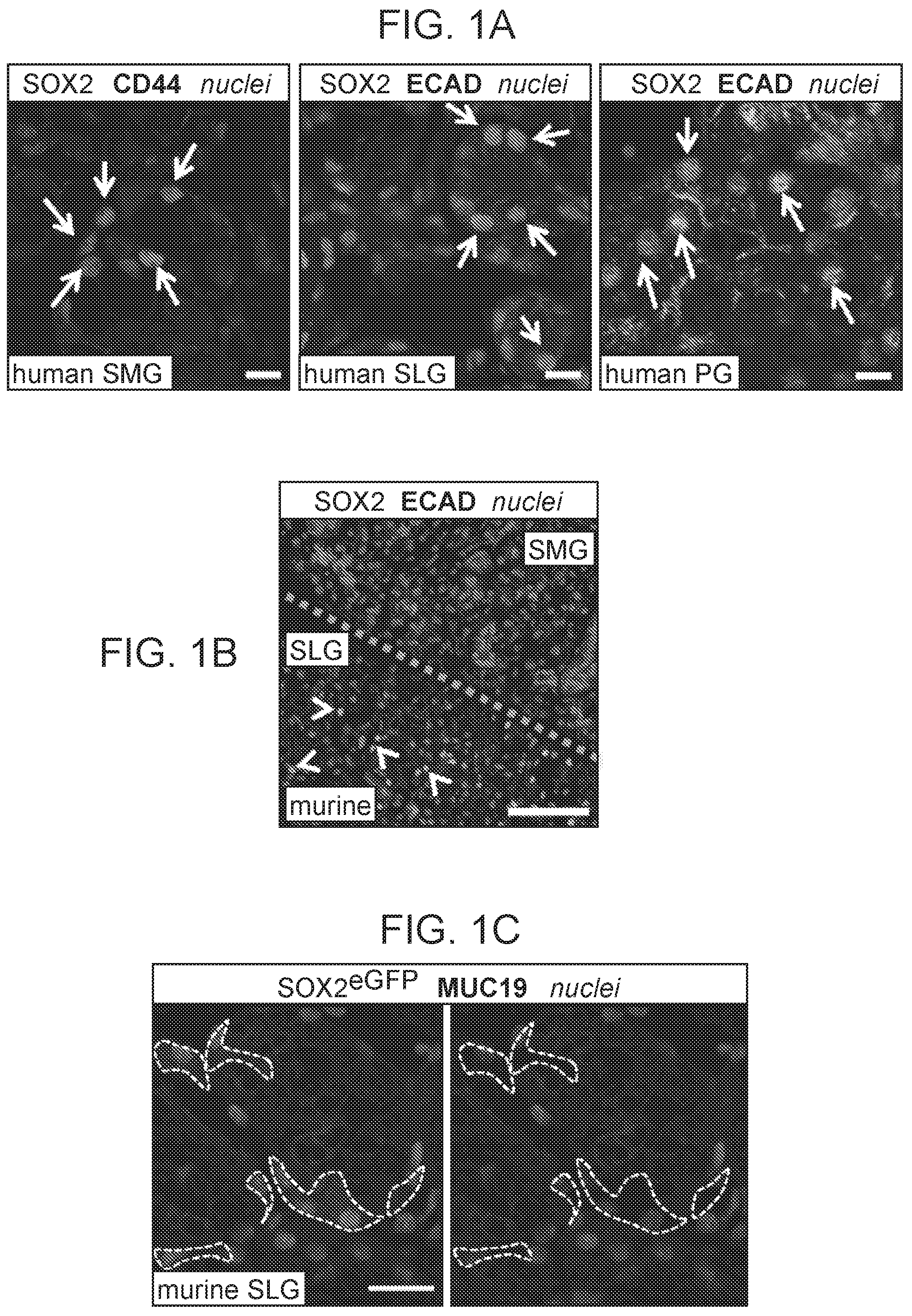 Patent US12310954 Figure 1 – Salivary gland regeneration