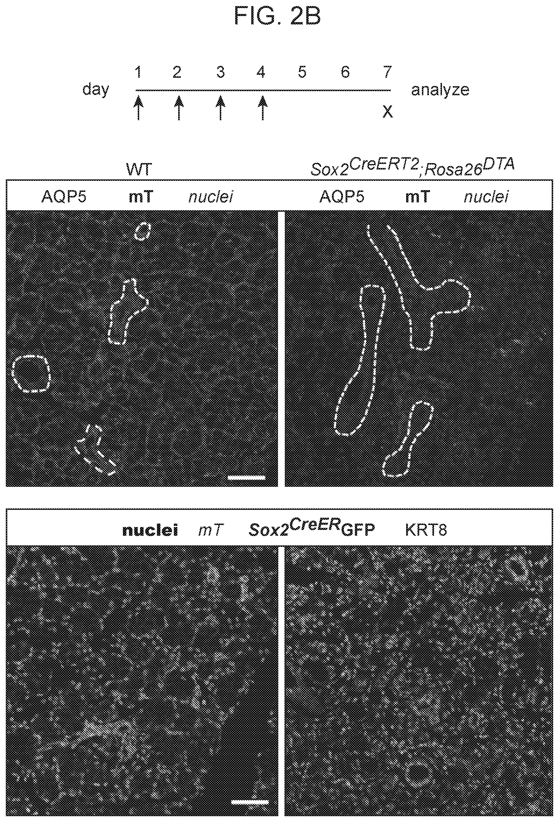 Patent US12310954 Figure 4 – Salivary gland regeneration