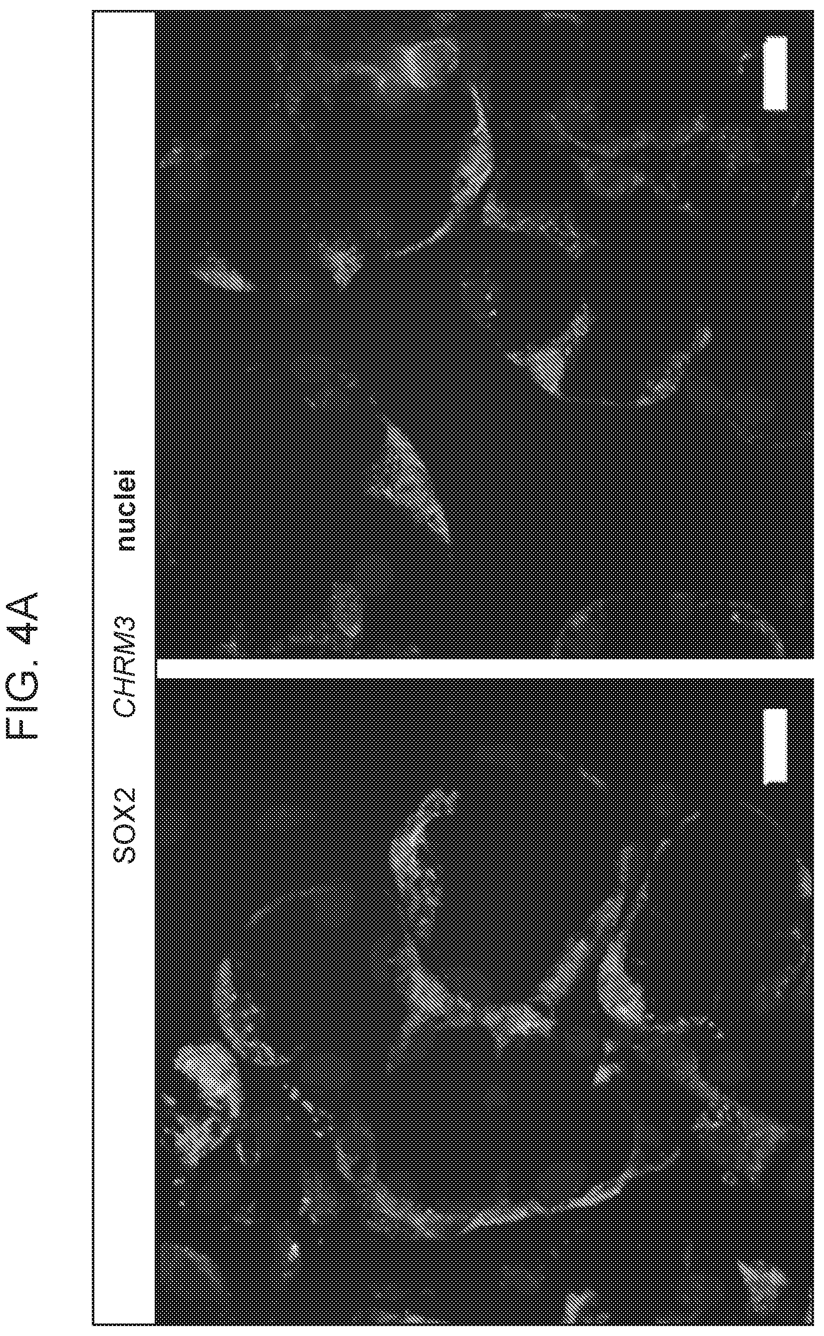 Patent US12310954 Figure 11 – Salivary gland regeneration
