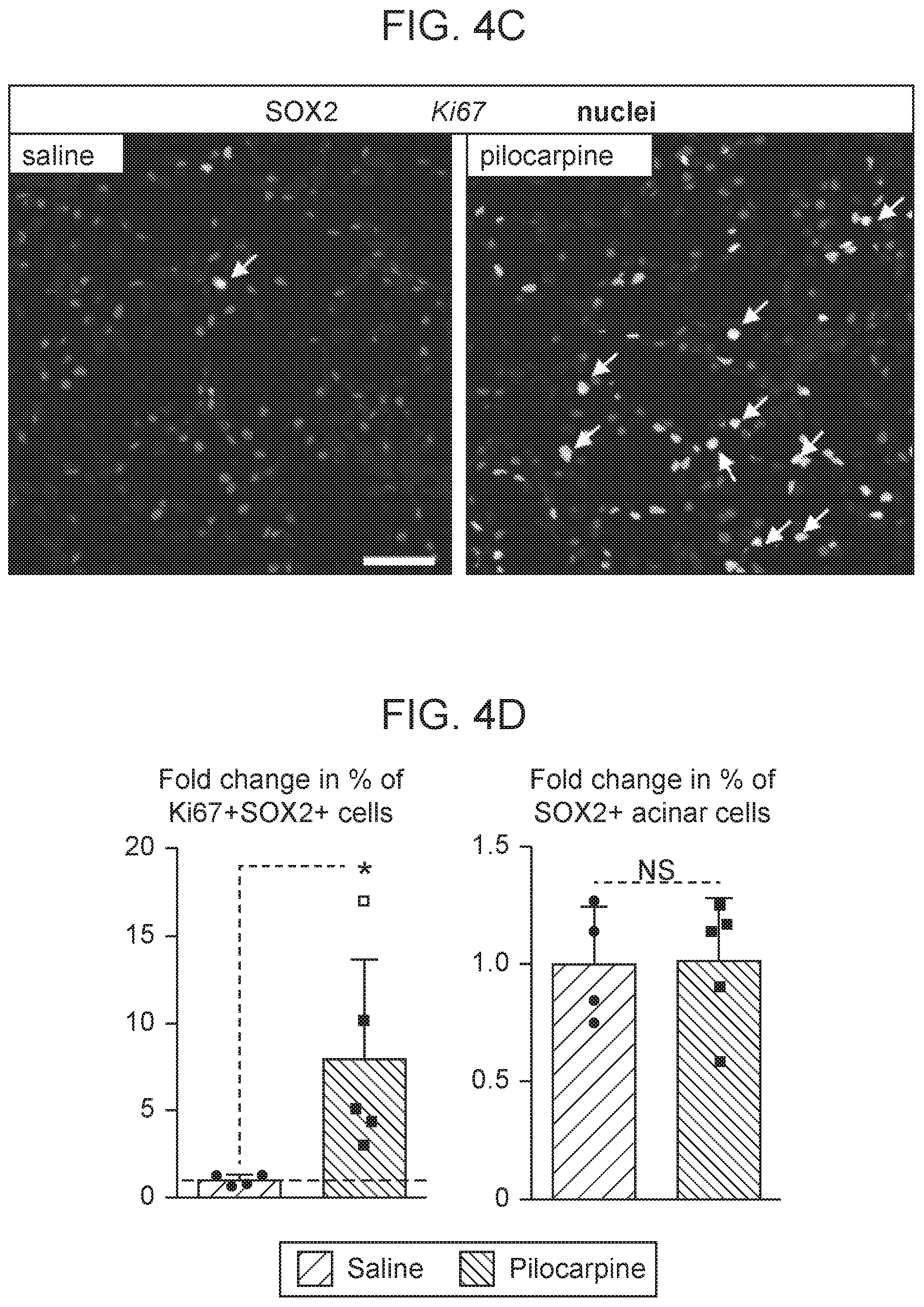Patent US12310954 Figure 13 – Salivary gland regeneration
