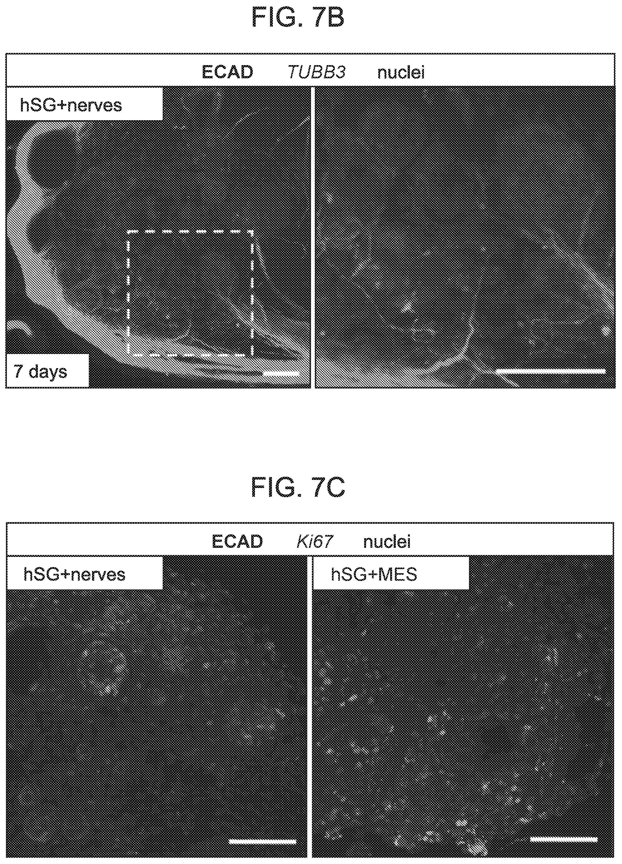 Patent US12310954 Figure 20 – Salivary gland regeneration