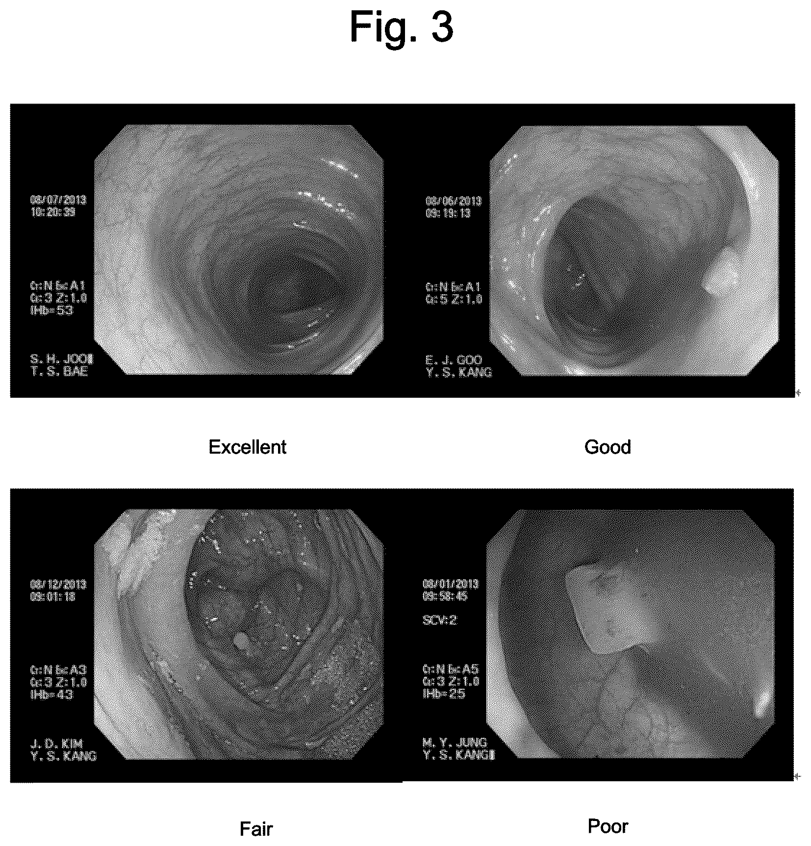 Patent US12310957 Figure 3 – Bowel cleansing composition
