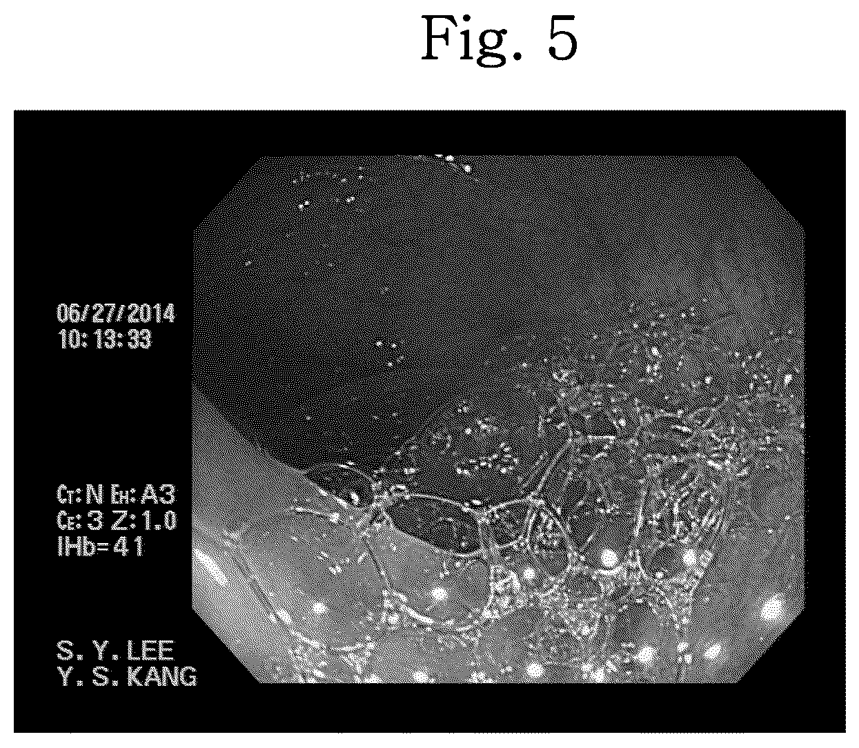 Patent US12310957 Figure 5 – Bowel cleansing composition