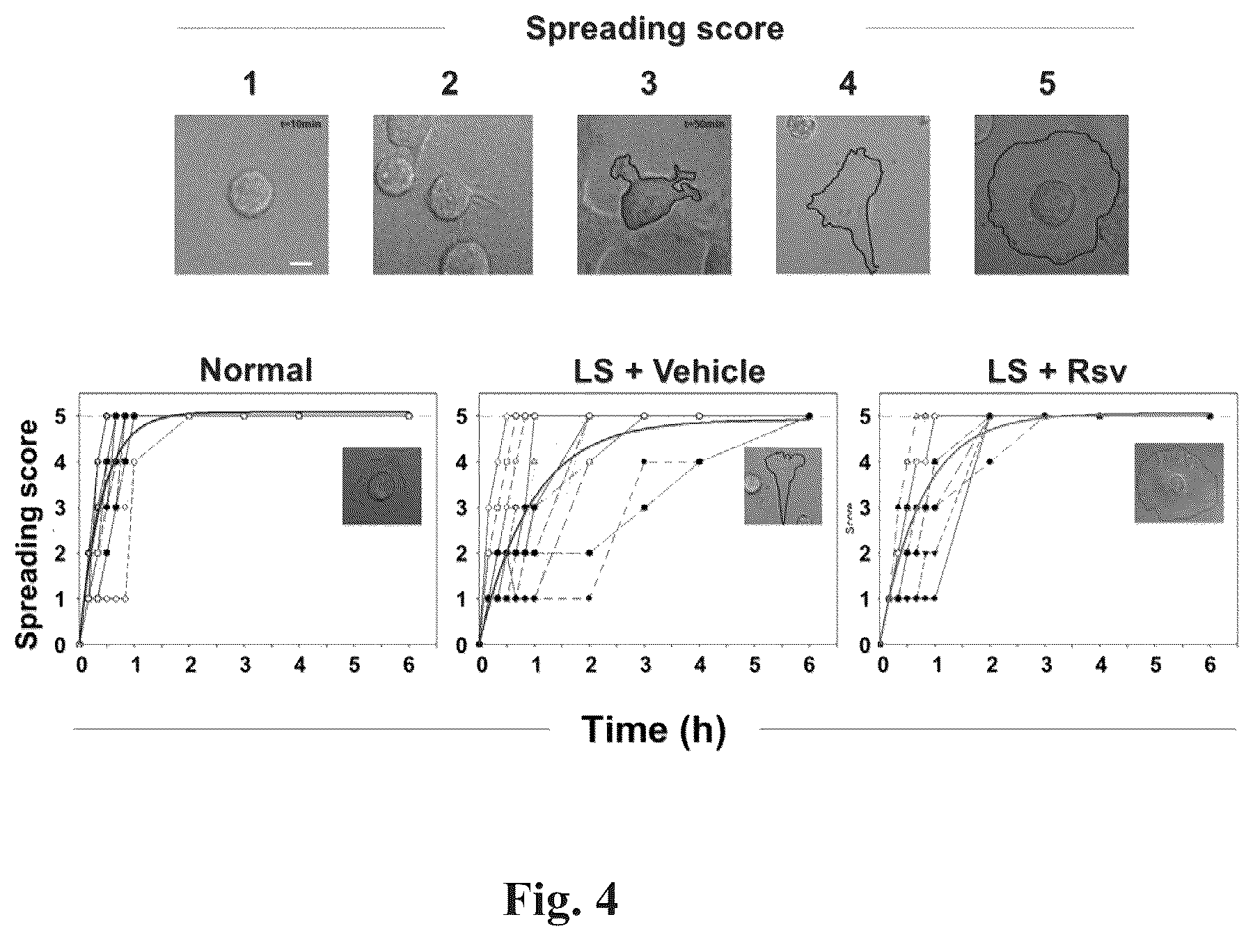 Patent US12310964 Figure 4 – Compositions and methods for the treatment of Lowe Syndrome