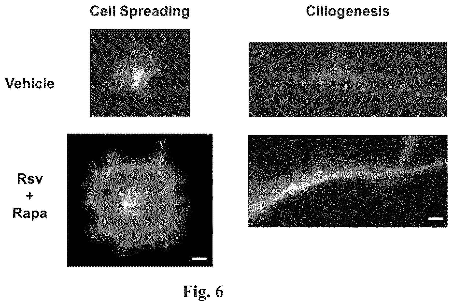 Patent US12310964 Figure 6 – Compositions and methods for the treatment of Lowe Syndrome