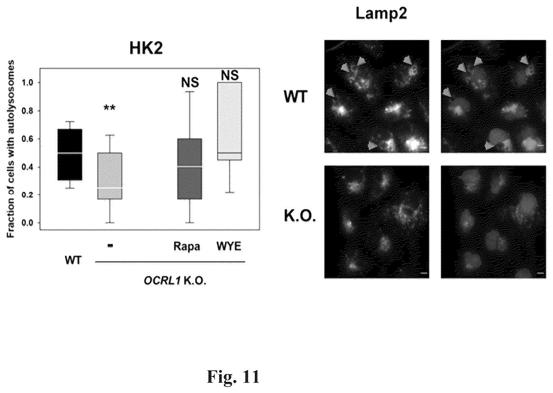 Patent US12310964 Figure 11 – Compositions and methods for the treatment of Lowe Syndrome