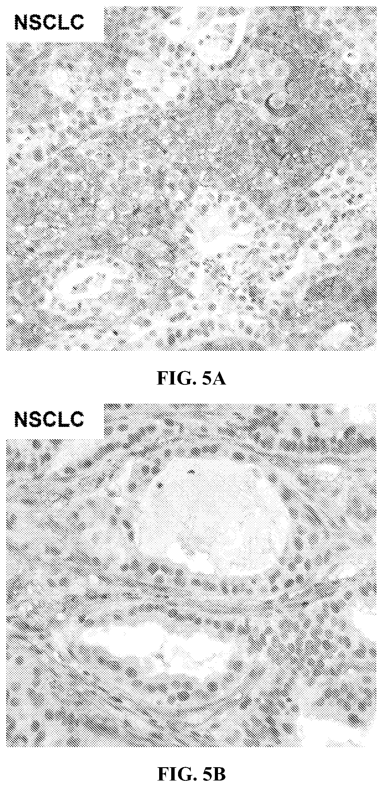 Patent US12310965 Figure 10 – Treatment of cancer utilizing an identified adenosine fingerprint