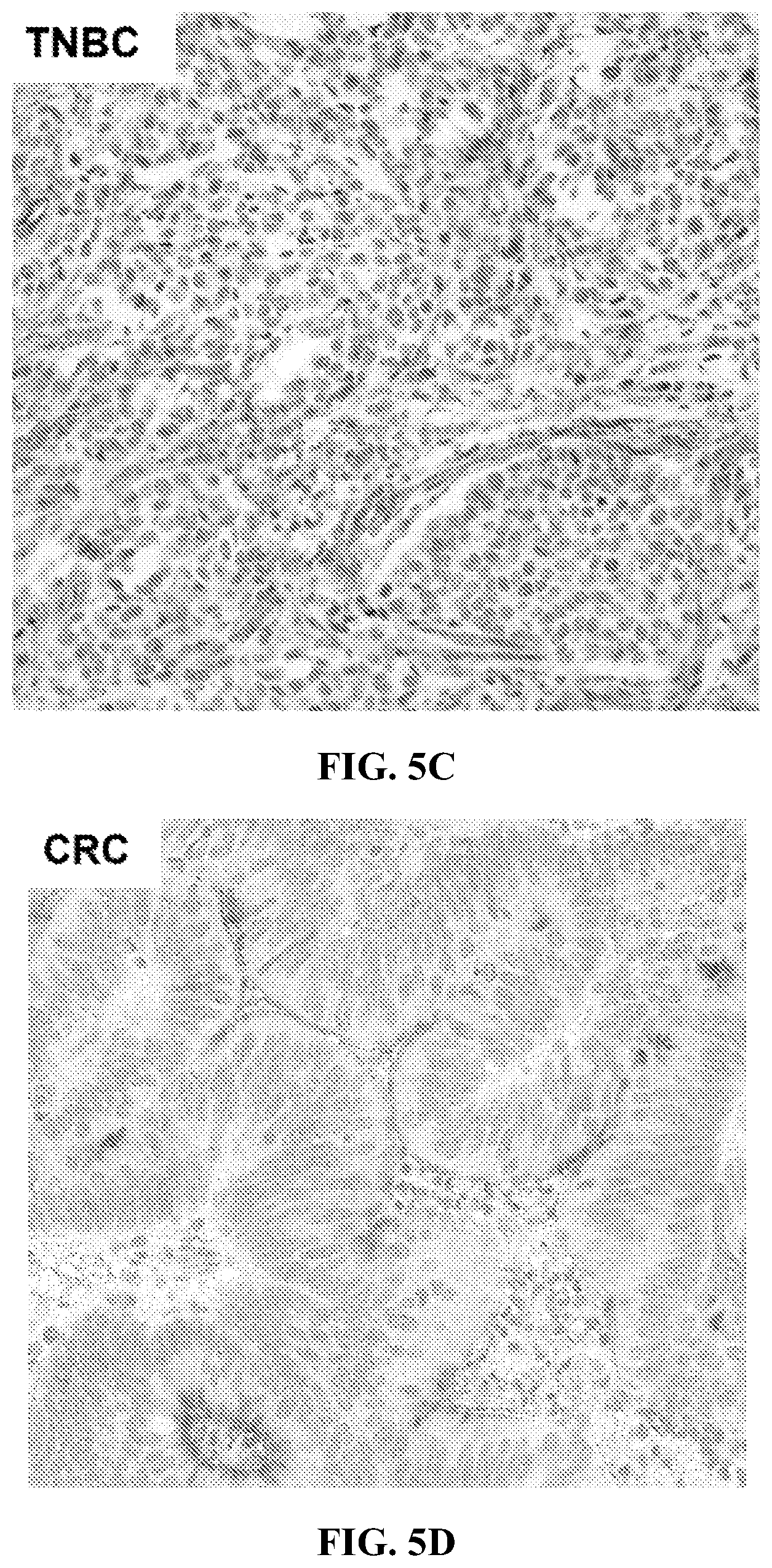 Patent US12310965 Figure 11 – Treatment of cancer utilizing an identified adenosine fingerprint