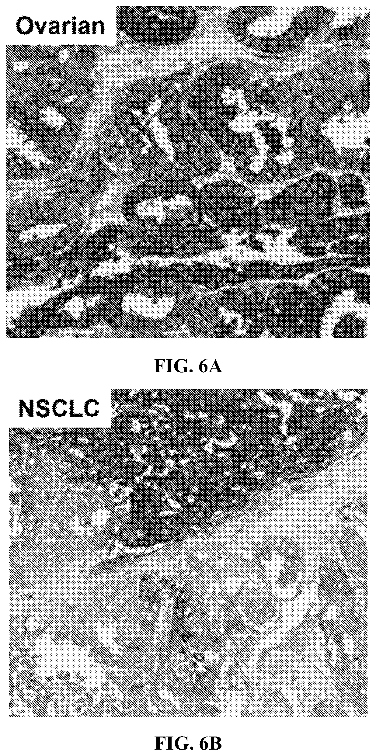 Patent US12310965 Figure 14 – Treatment of cancer utilizing an identified adenosine fingerprint