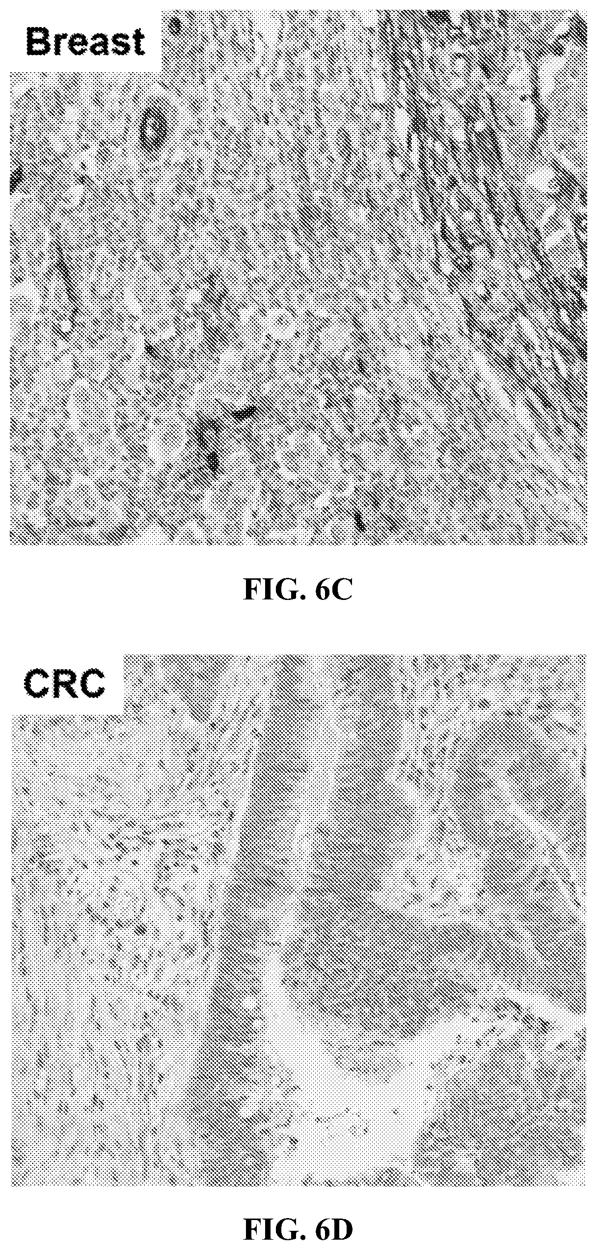 Patent US12310965 Figure 15 – Treatment of cancer utilizing an identified adenosine fingerprint