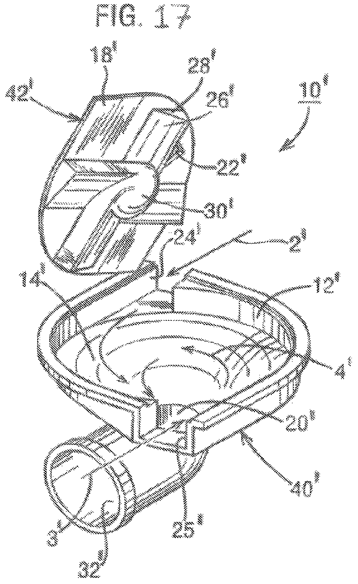 Patent US12310979 Figure 9 – Inhalable formulation of fluticasone propionate and albuterol sulfate