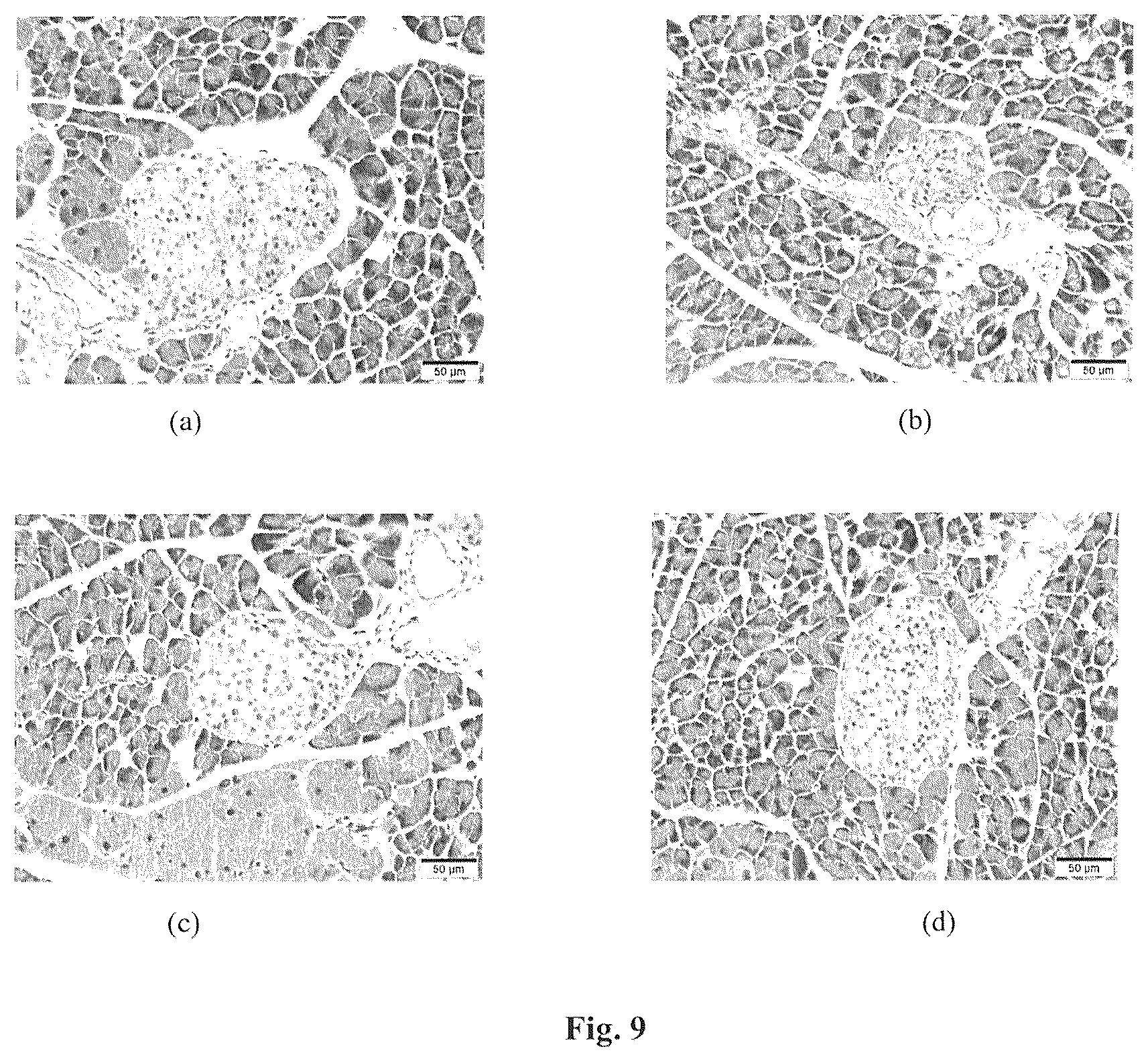 Patent US12310985 Figure 8 – Composition and method for treatment of diabetes