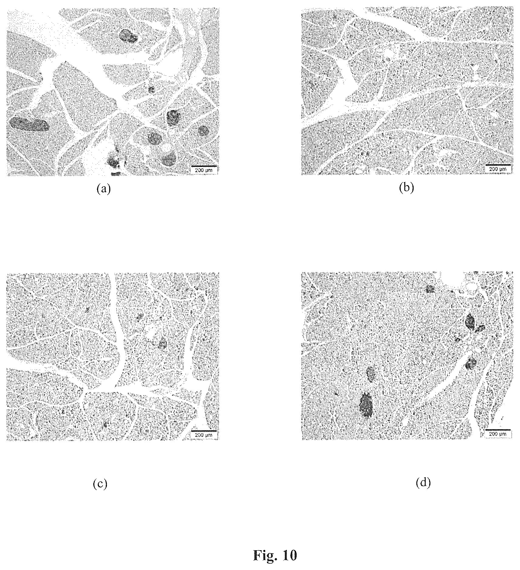 Patent US12310985 Figure 9 – Composition and method for treatment of diabetes