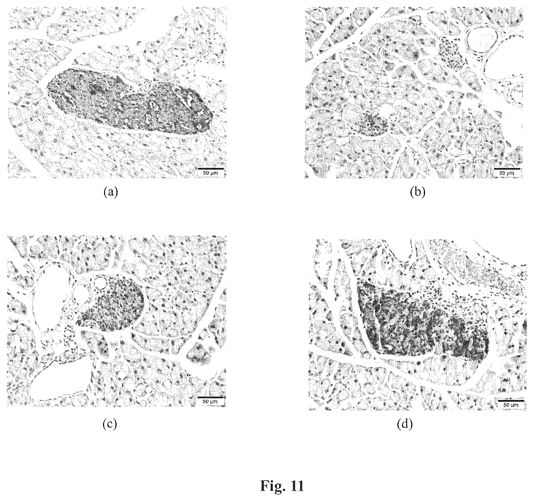 Patent US12310985 Figure 10 – Composition and method for treatment of diabetes