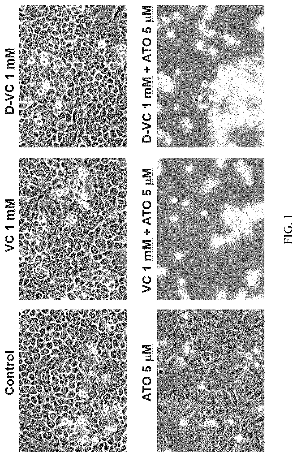 Patent US12310986 Figure 1 – Compositions and methods for the treatment of cancer cells by induction of cytotoxic oxidative stress