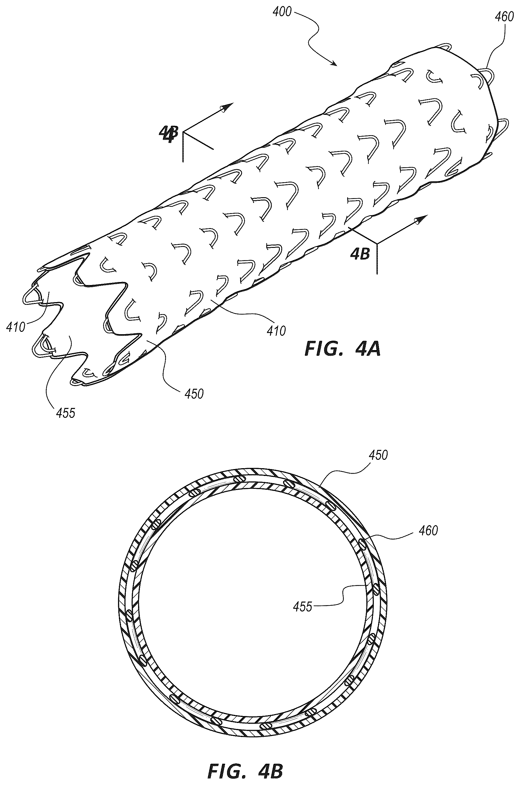 Patent US12310987 Figure 4 – Fibrous constructs with therapeutic material particles