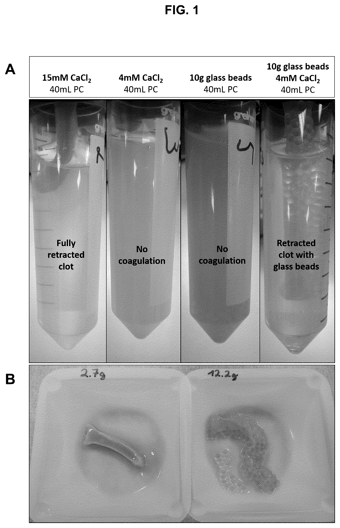 Patent US12310989 — Methods for preparing platelet releasate — Figure 1