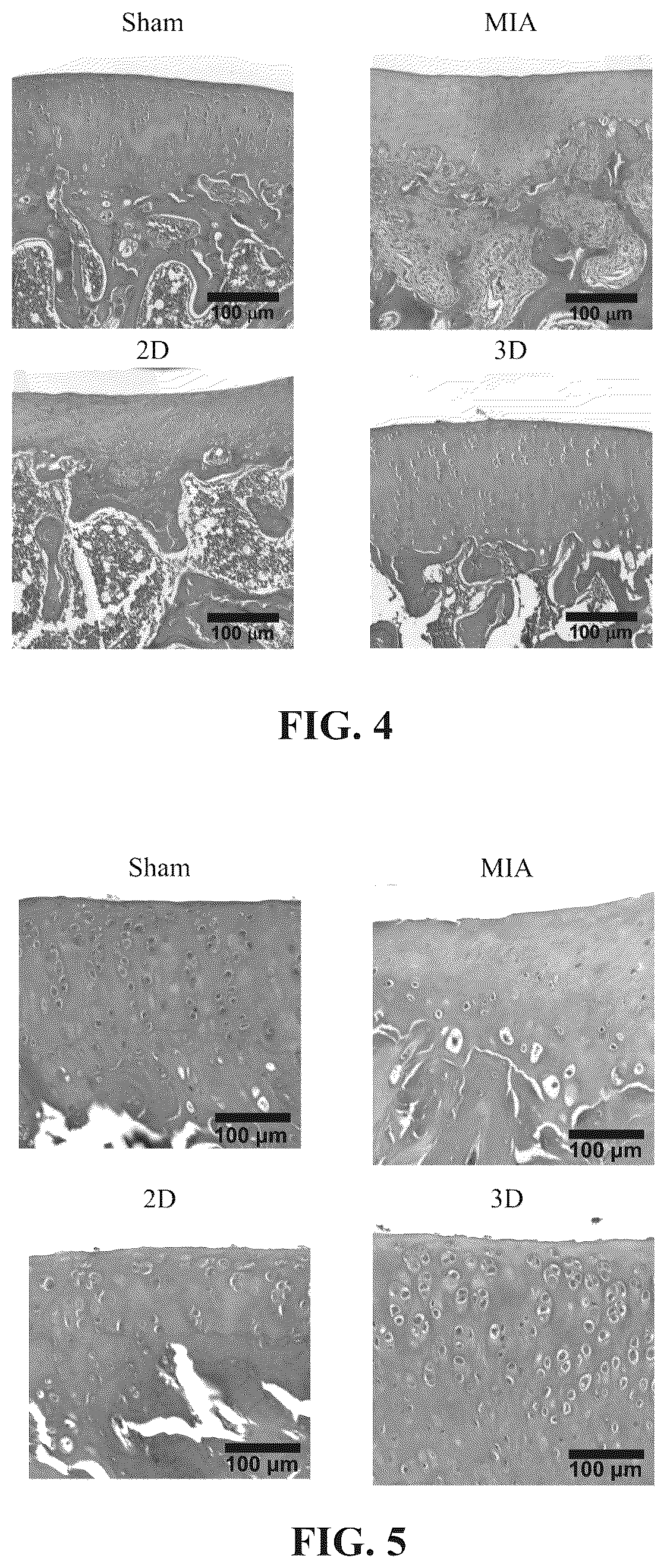 Patent US12310990 Figure 4 – Method for treating arthritis by using stem cell preparation and method for preparing stem cell preparation