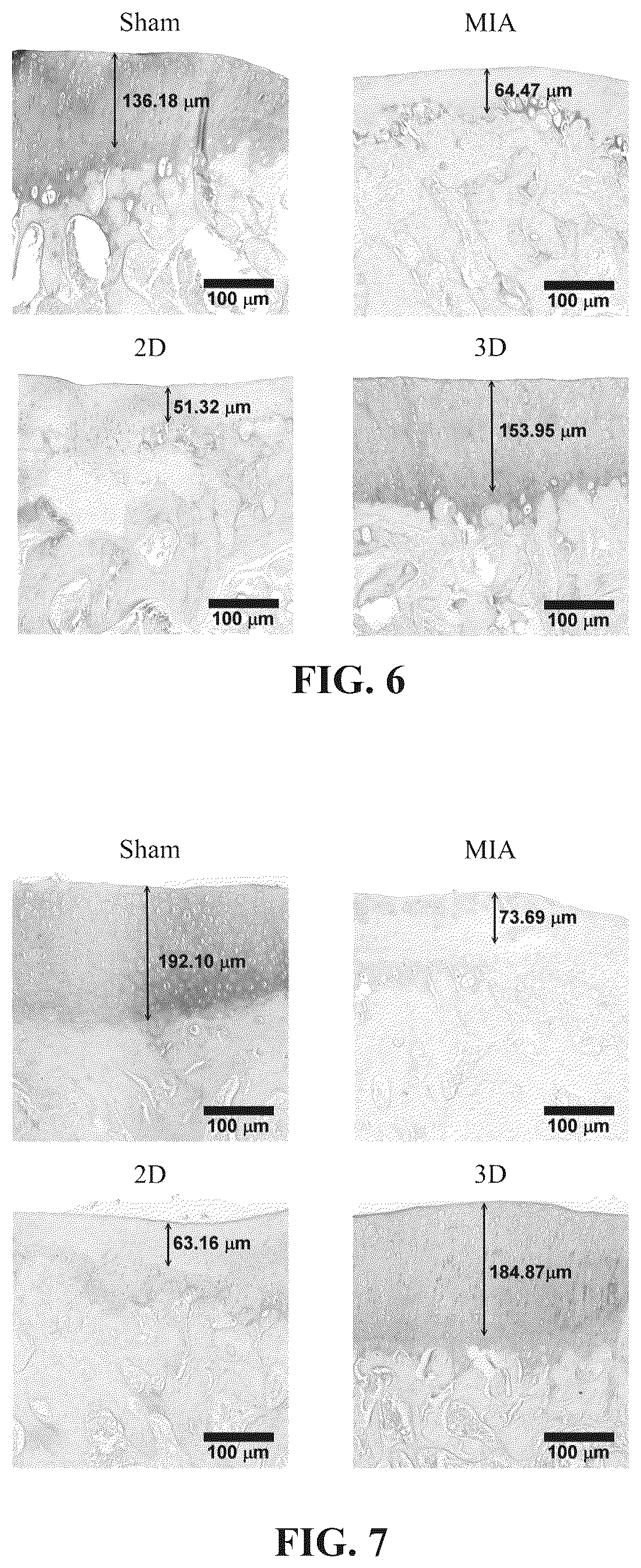 Patent US12310990 Figure 5 – Method for treating arthritis by using stem cell preparation and method for preparing stem cell preparation