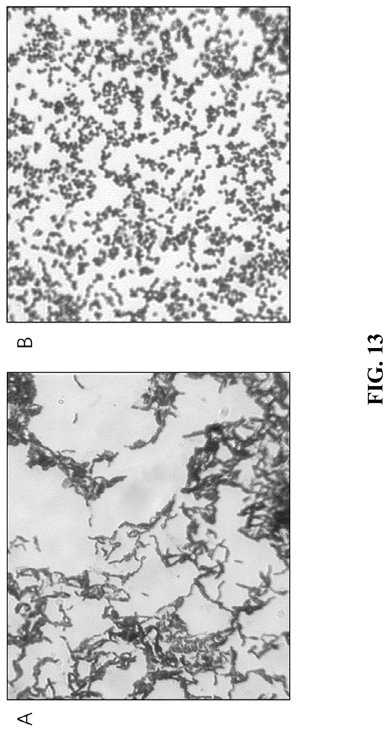 Patent US12310995 Figure 12 – Gut microbes against infectious diseases and its use