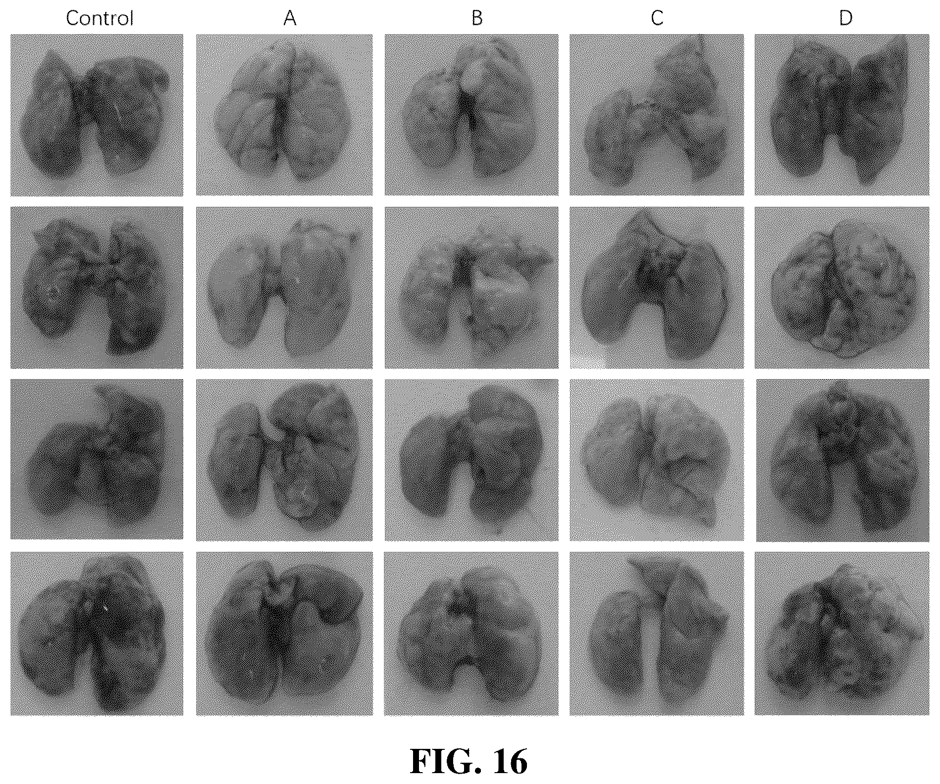 Patent US12310995 Figure 15 – Gut microbes against infectious diseases and its use