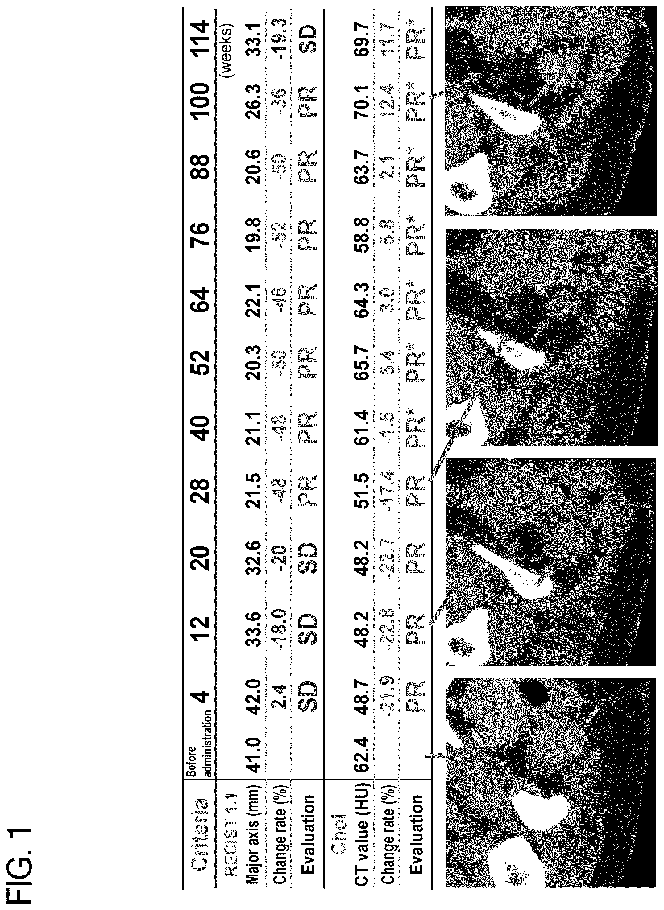 Patent US12310998 Figure 1 – Therapeutic pharmaceutical composition for bone and soft tissue tumors