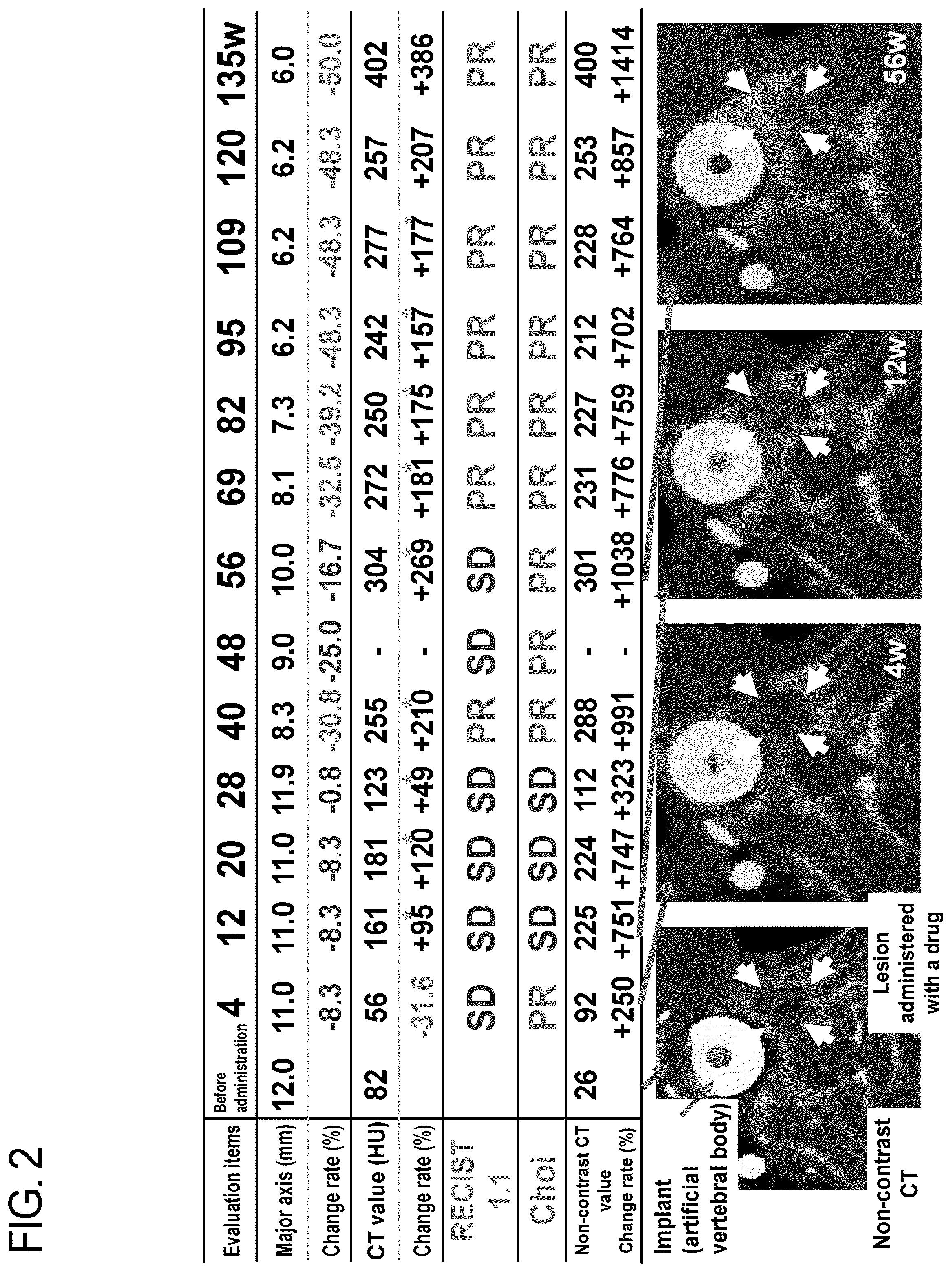 Patent US12310998 Figure 2 – Therapeutic pharmaceutical composition for bone and soft tissue tumors