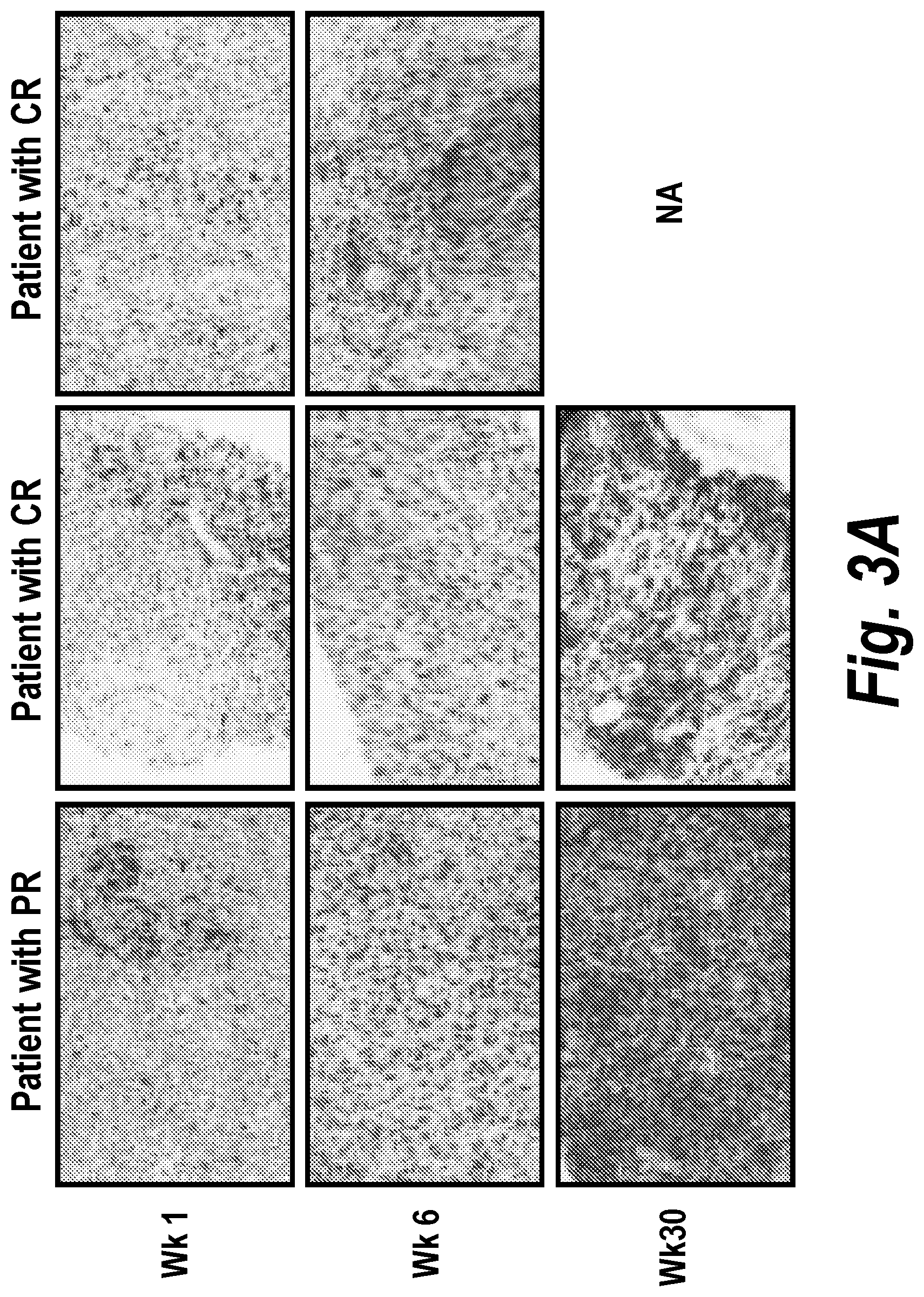 Patent US12310999 Figure 5 – Biomarkers for cancer therapeutics
