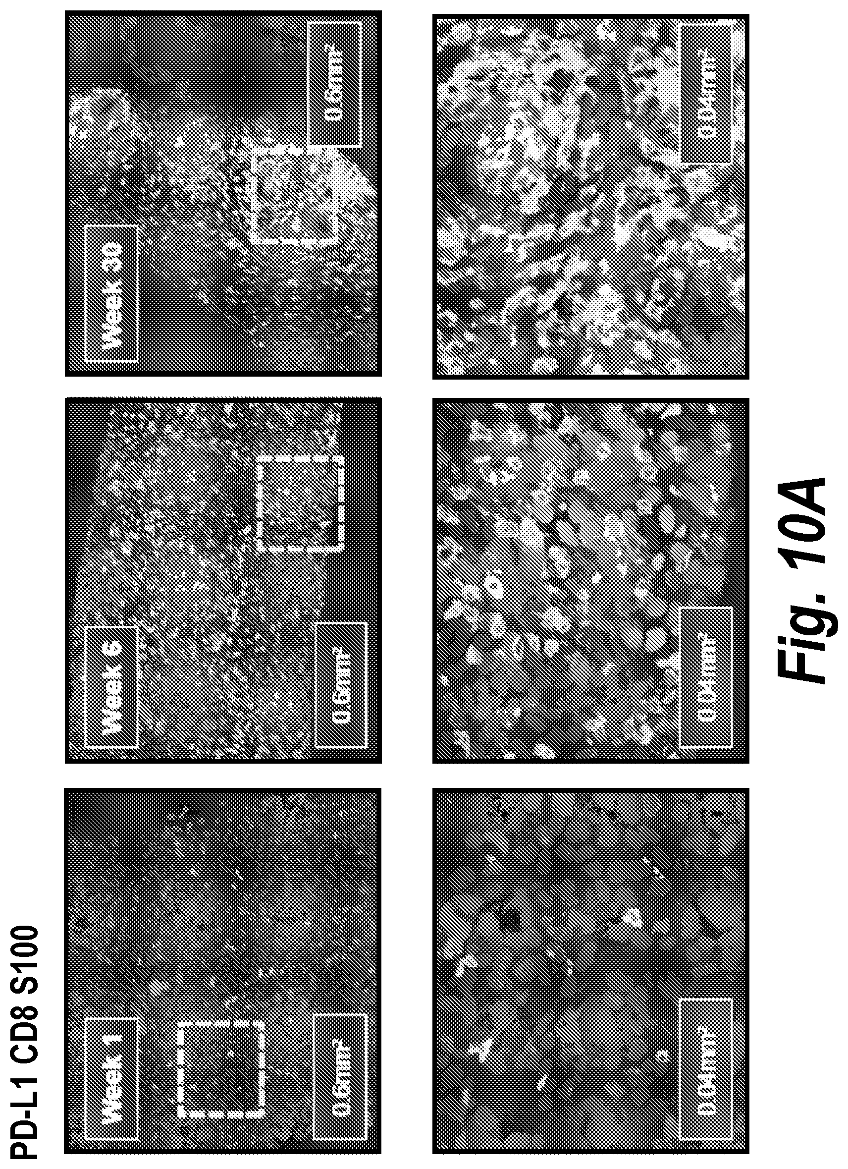 Patent US12310999 Figure 18 – Biomarkers for cancer therapeutics