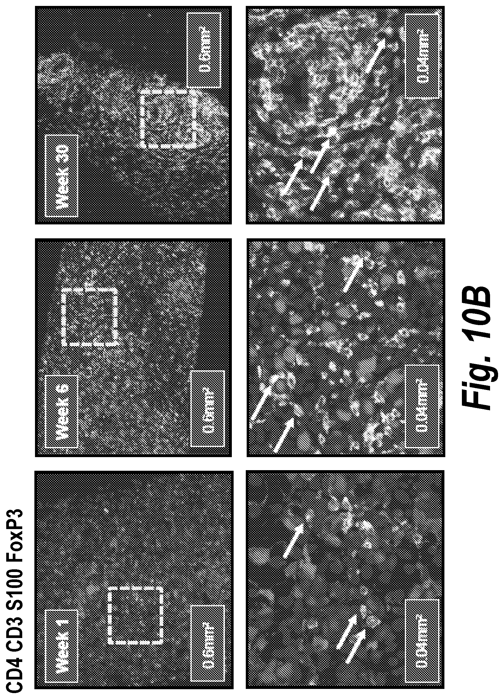 Patent US12310999 Figure 19 – Biomarkers for cancer therapeutics