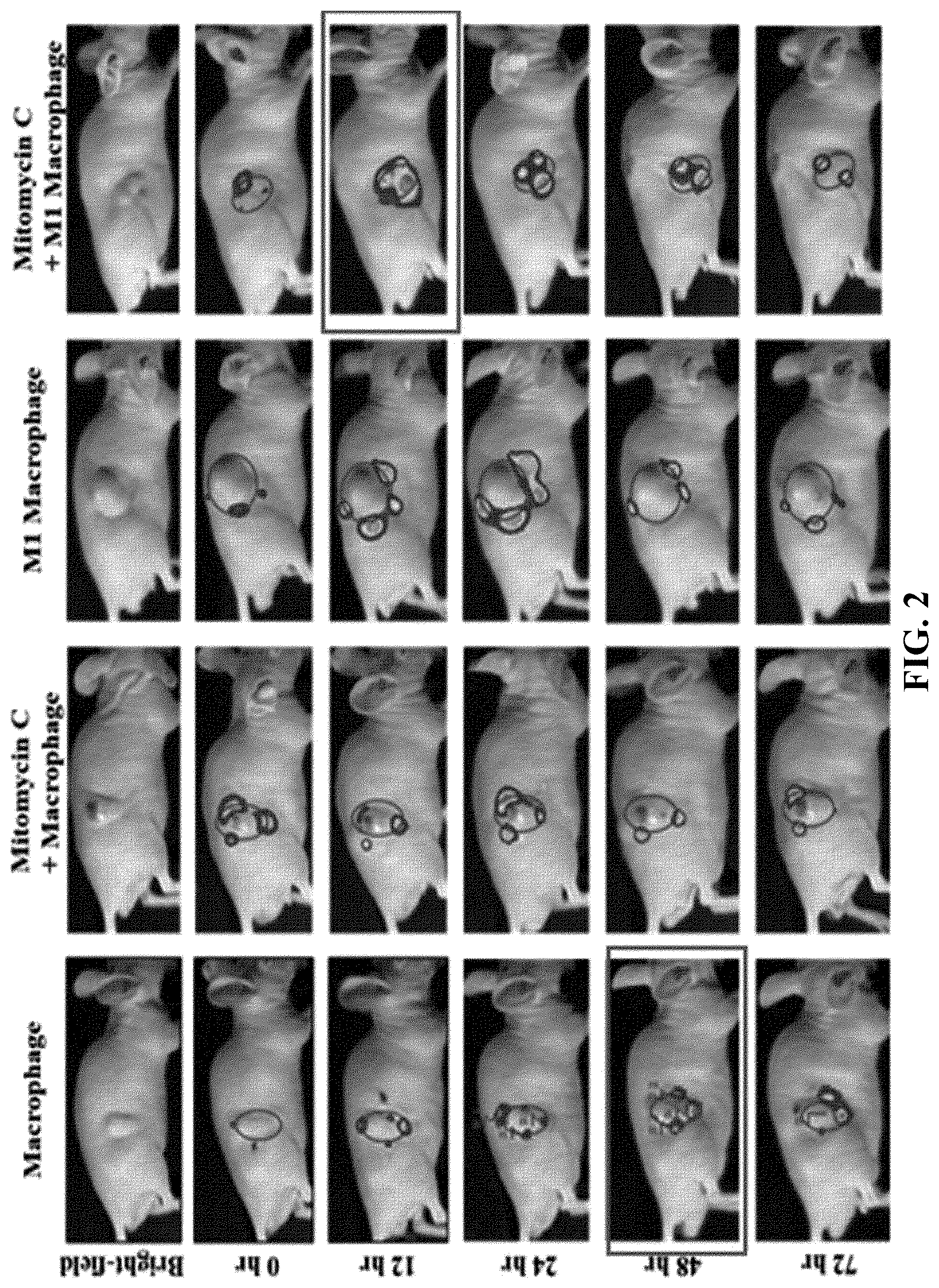 Patent US12311024 Figure 2 – Cancer cell-targeted drug delivery carrier and composition for promoting photo-thermal treatment effects, both of which contain M1 macrophages as active ingredient