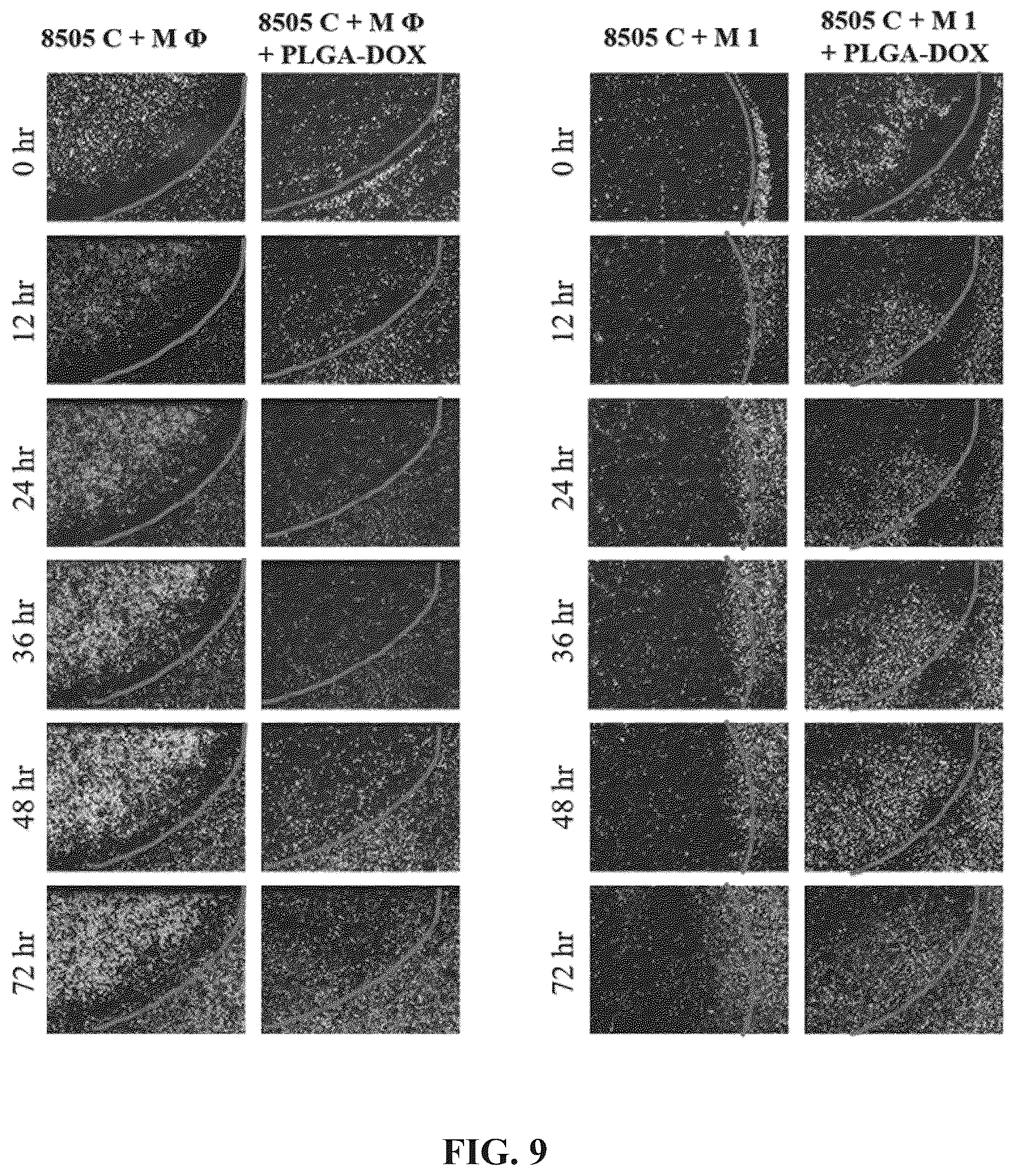 Patent US12311024 Figure 8 – Cancer cell-targeted drug delivery carrier and composition for promoting photo-thermal treatment effects, both of which contain M1 macrophages as active ingredient