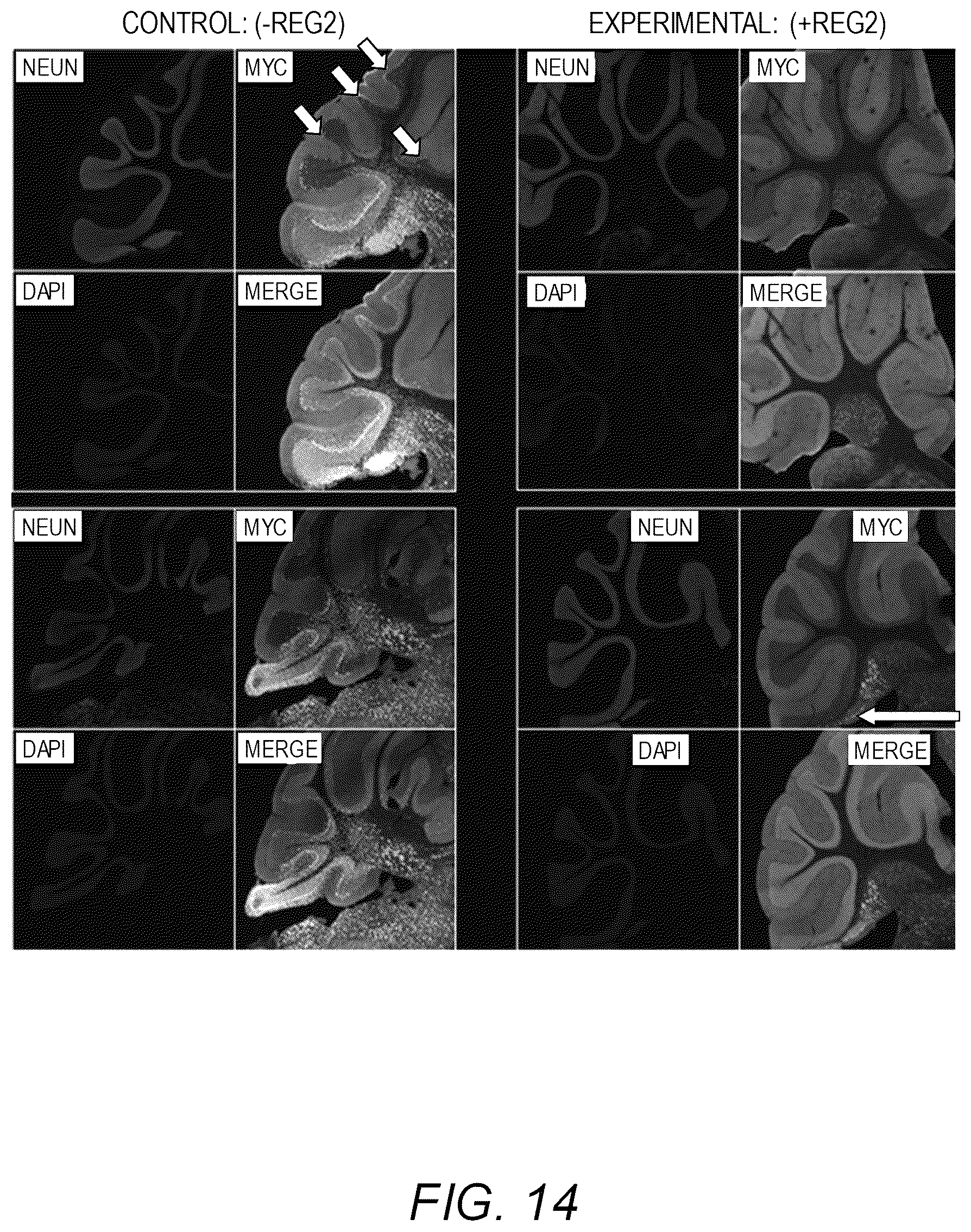 Patent US12311034 Figure 16 – Feedback enabled synthetic genes, target seed match cassettes, and their uses
