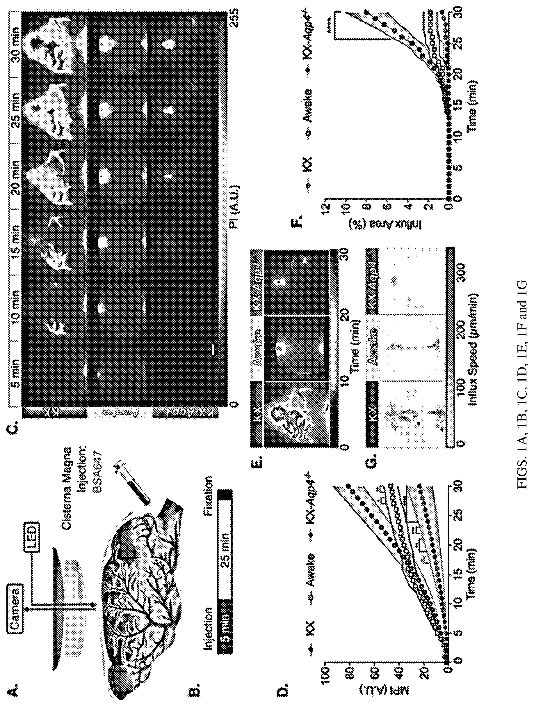 Patent US12311035 Figure 1 – Glymphatic delivery by manipulating plasma osmolarity