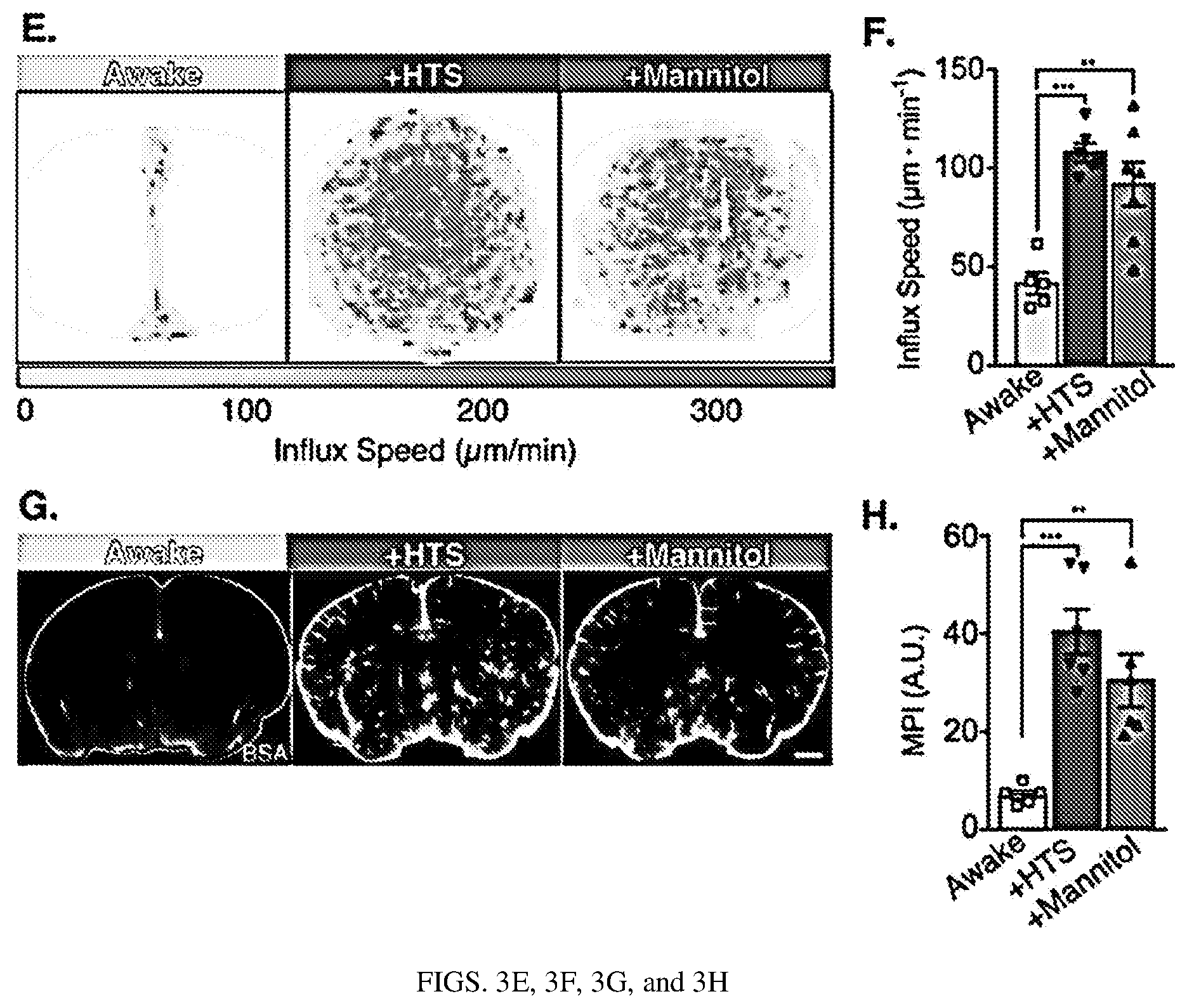 Patent US12311035 Figure 6 – Glymphatic delivery by manipulating plasma osmolarity