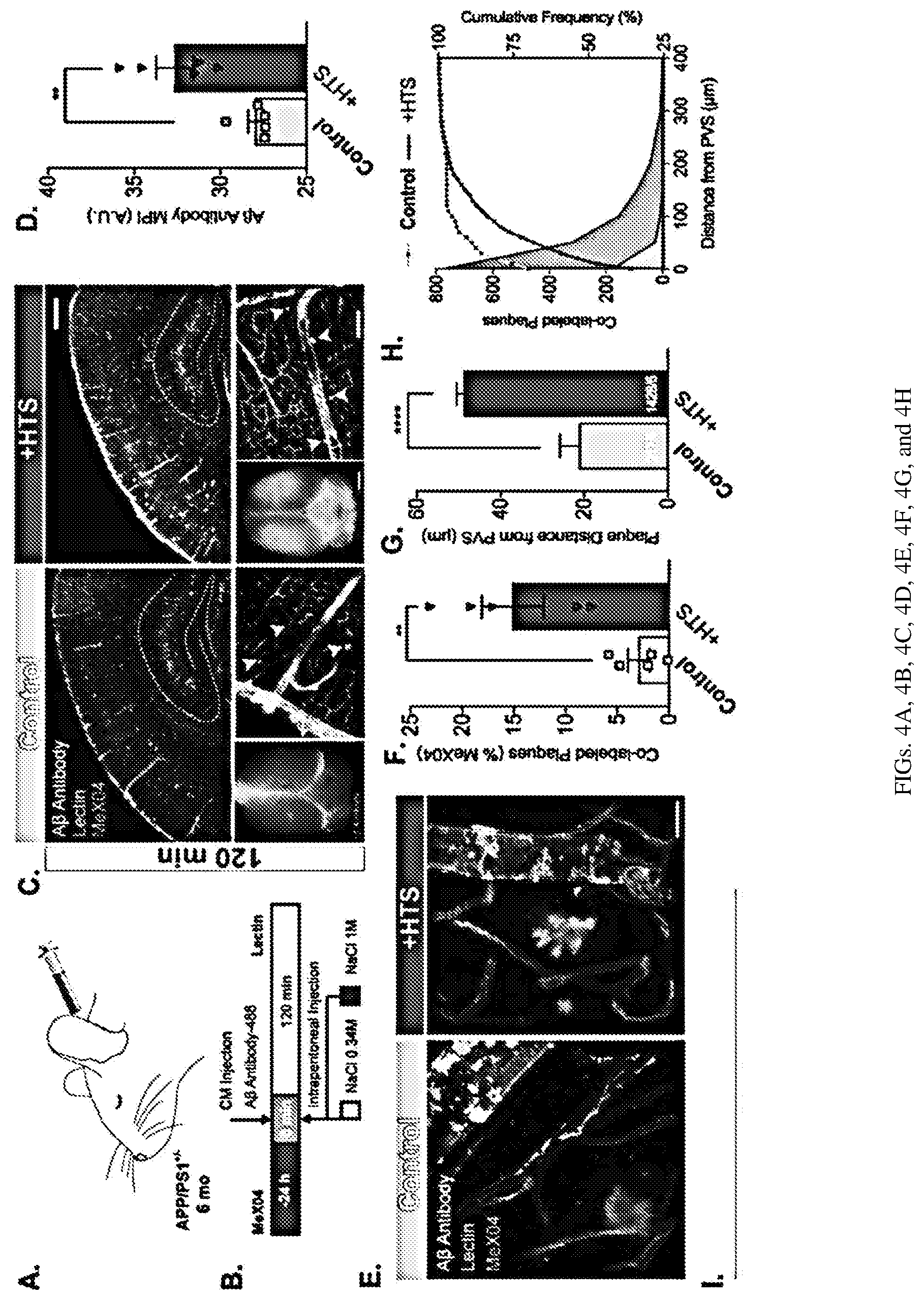 Patent US12311035 Figure 7 – Glymphatic delivery by manipulating plasma osmolarity