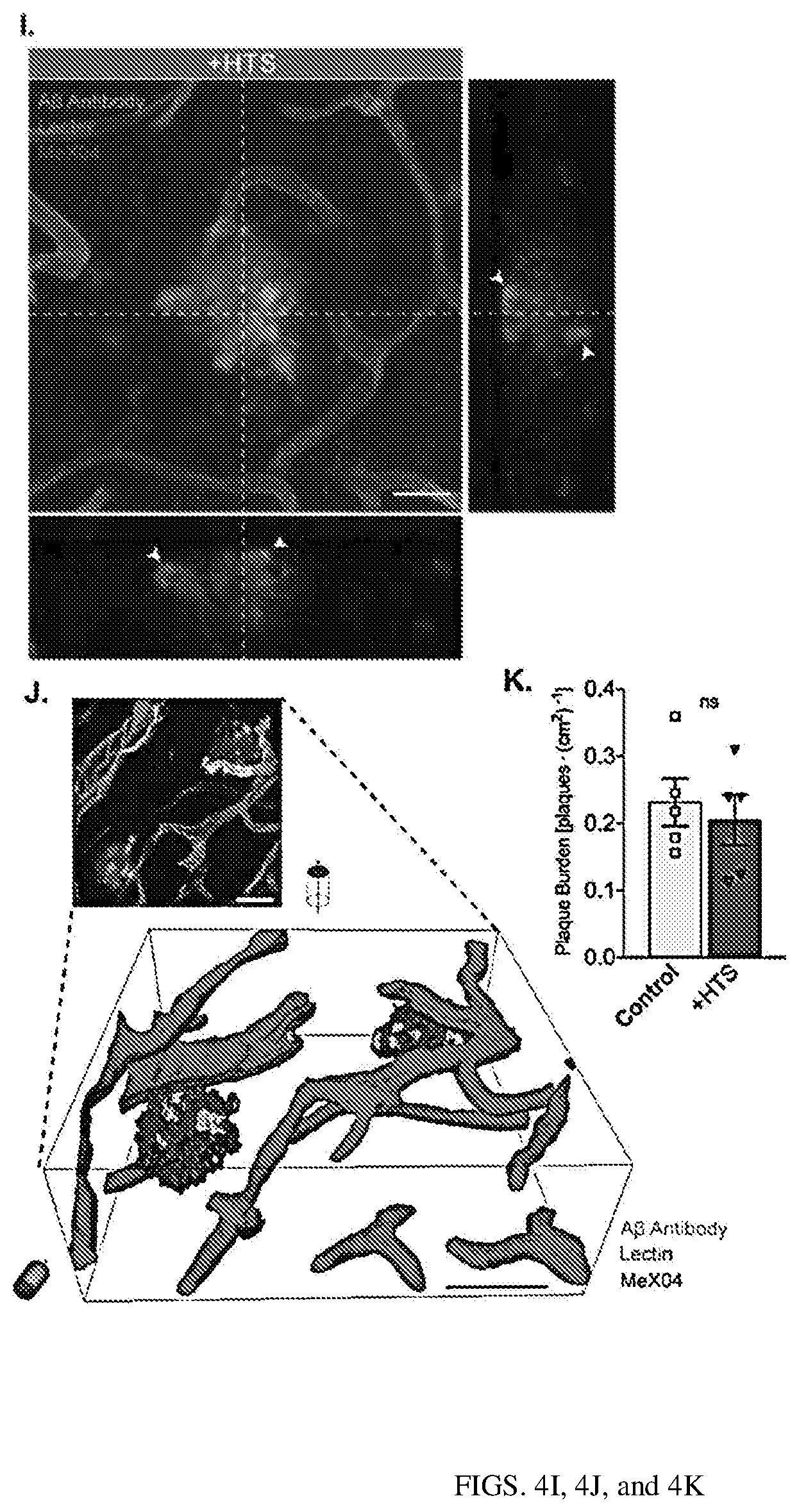 Patent US12311035 Figure 8 – Glymphatic delivery by manipulating plasma osmolarity