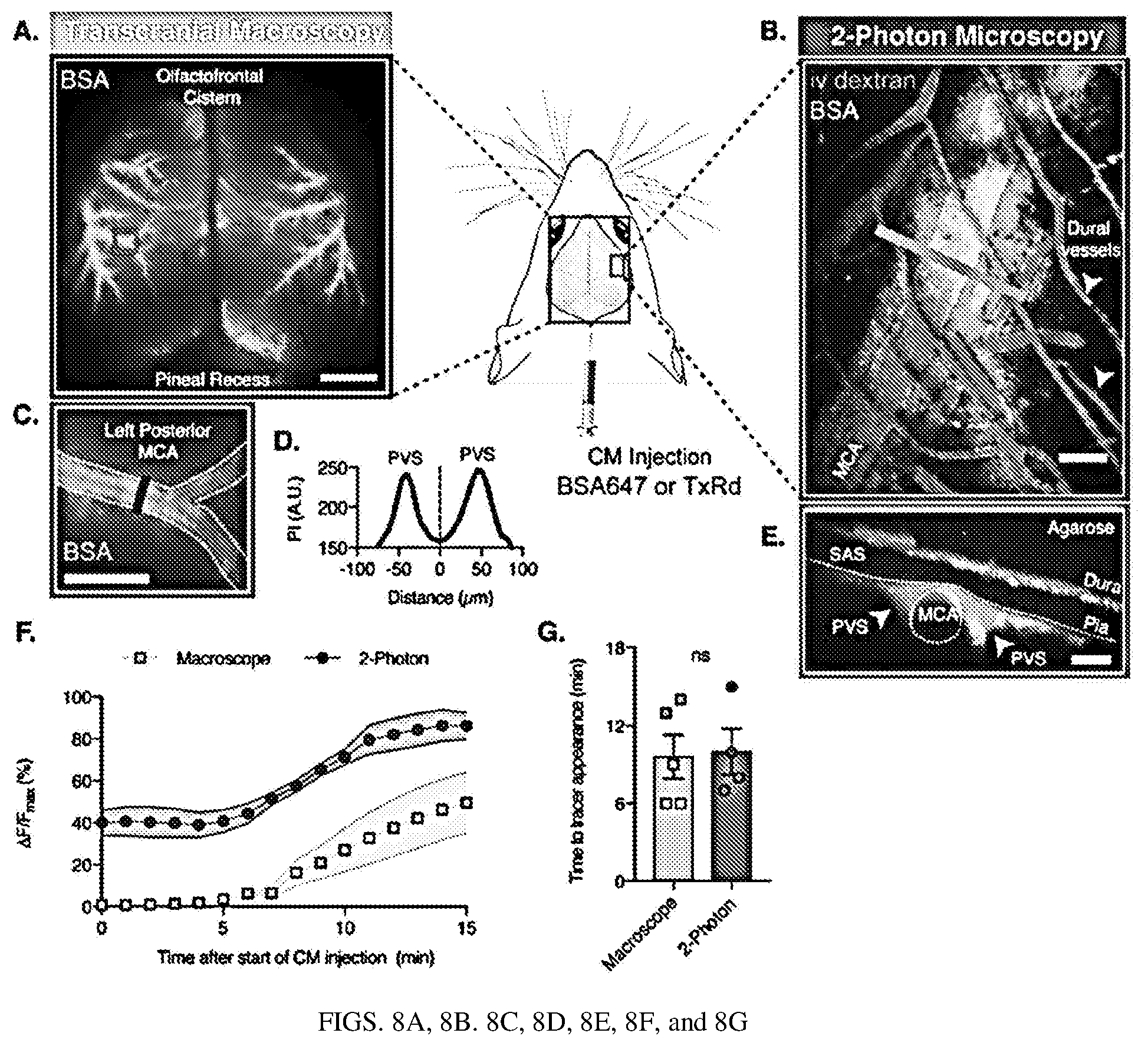 Patent US12311035 Figure 12 – Glymphatic delivery by manipulating plasma osmolarity