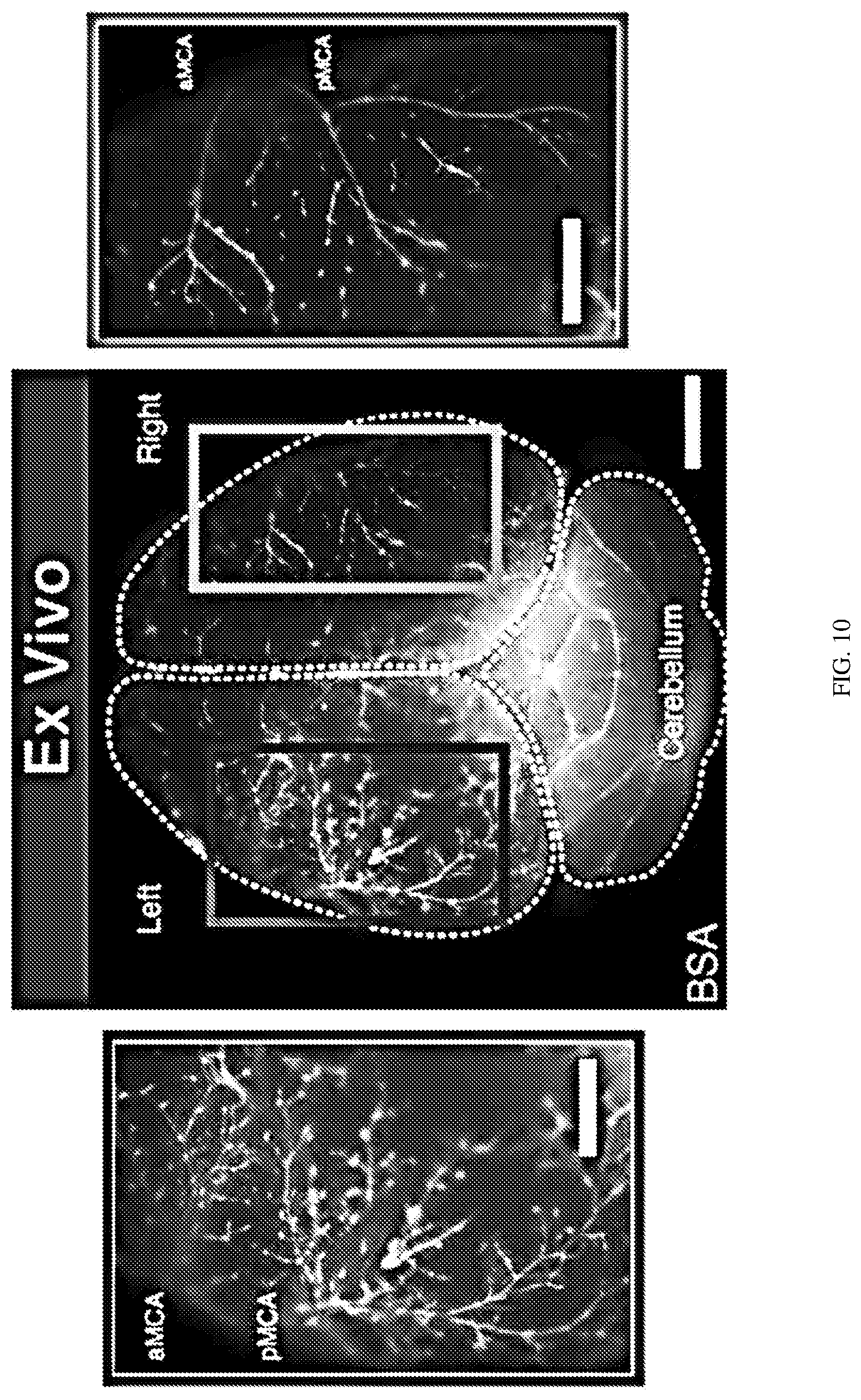 Patent US12311035 Figure 14 – Glymphatic delivery by manipulating plasma osmolarity