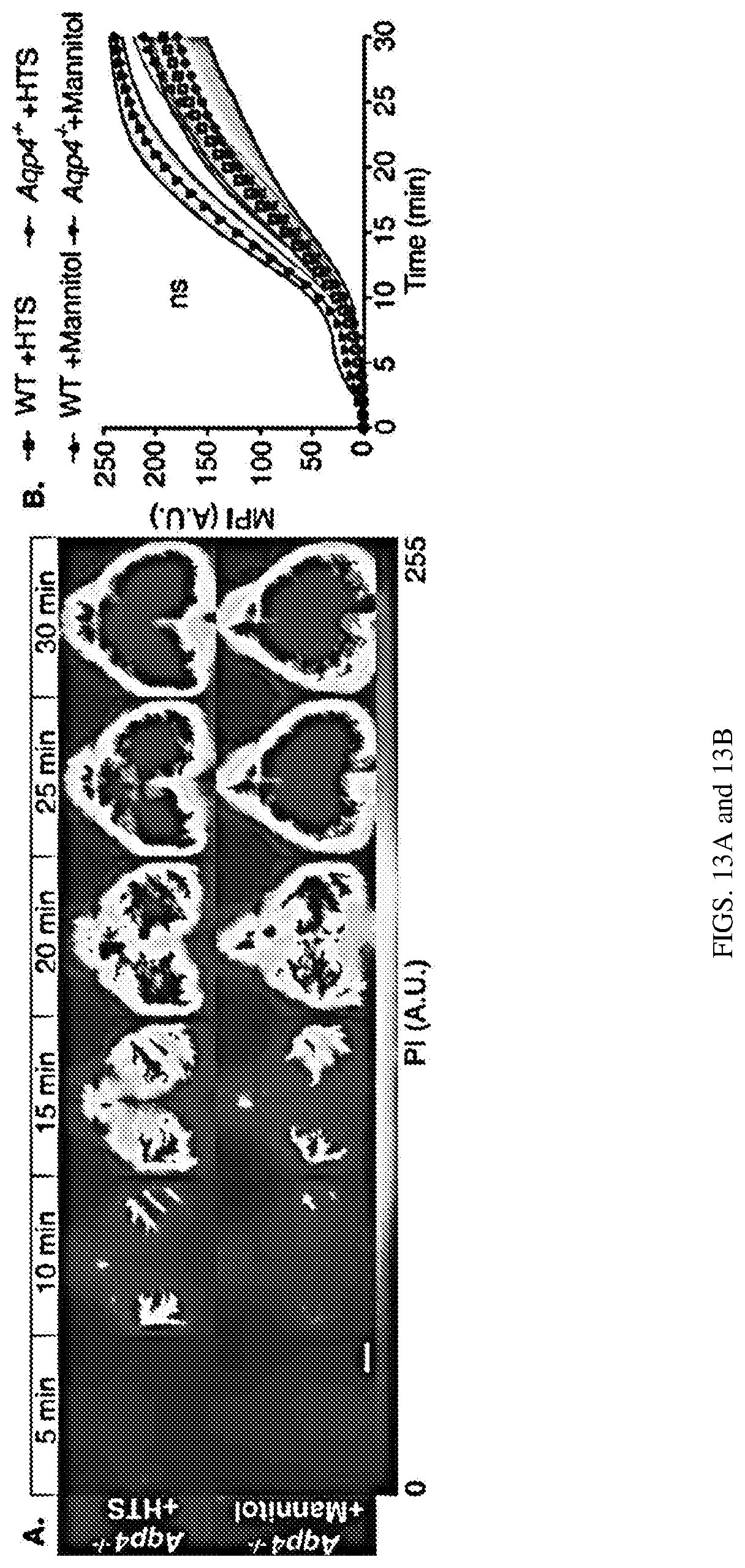Patent US12311035 Figure 17 – Glymphatic delivery by manipulating plasma osmolarity