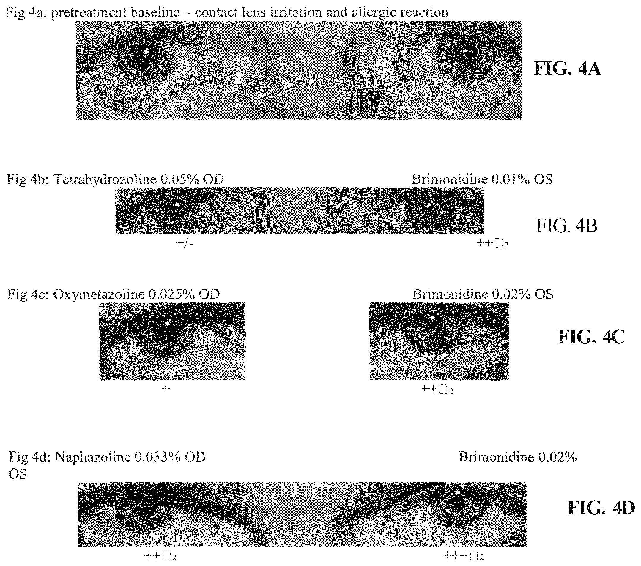 Patent US12311050 Figure 4 – Vasoconstriction compositions and methods of use