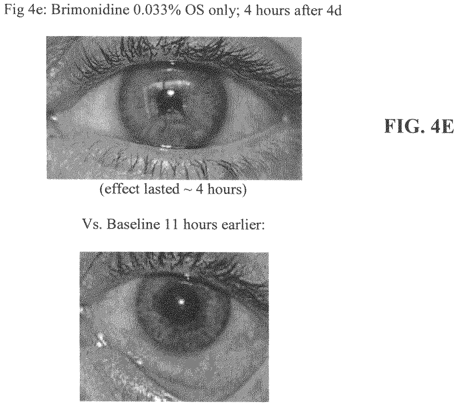 Patent US12311050 Figure 5 – Vasoconstriction compositions and methods of use