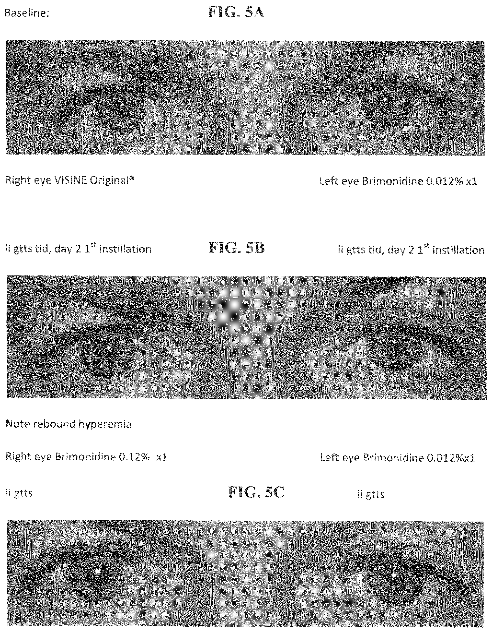 Patent US12311050 Figure 6 – Vasoconstriction compositions and methods of use