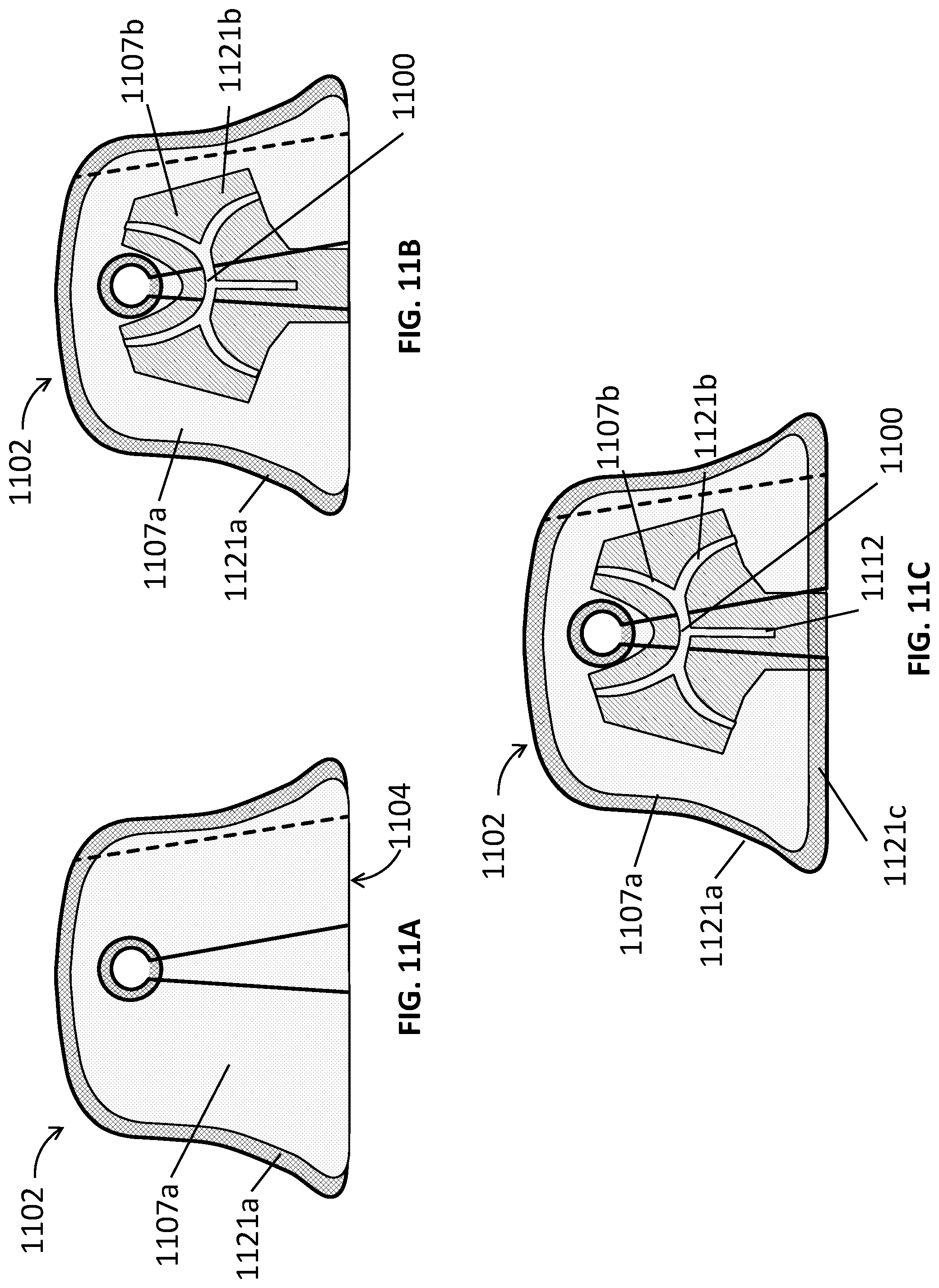 Patent US12311062 Figure 12 – Expanding foam-fabric orthopedic limb stabilization device