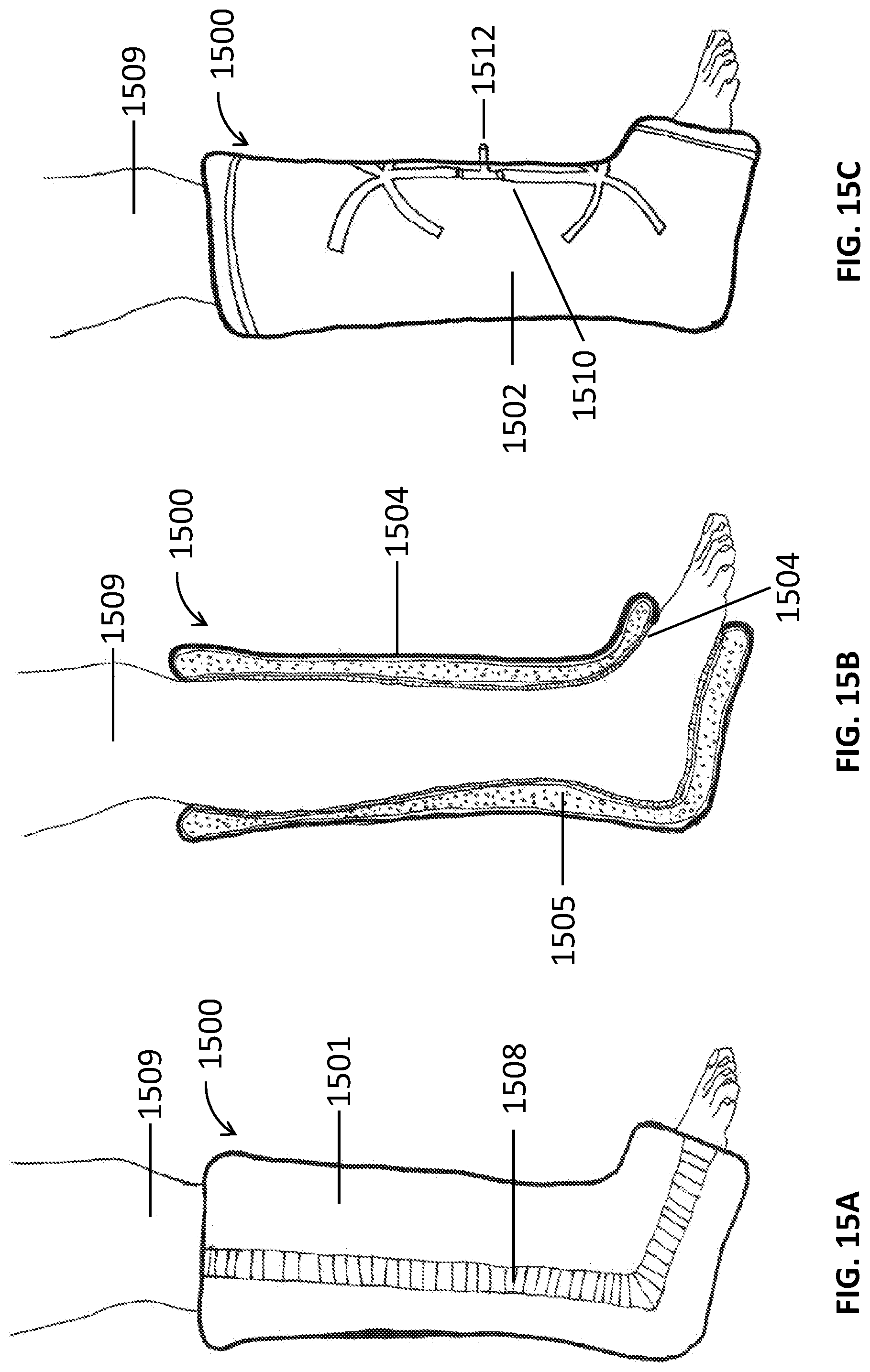 Patent US12311062 Figure 16 – Expanding foam-fabric orthopedic limb stabilization device
