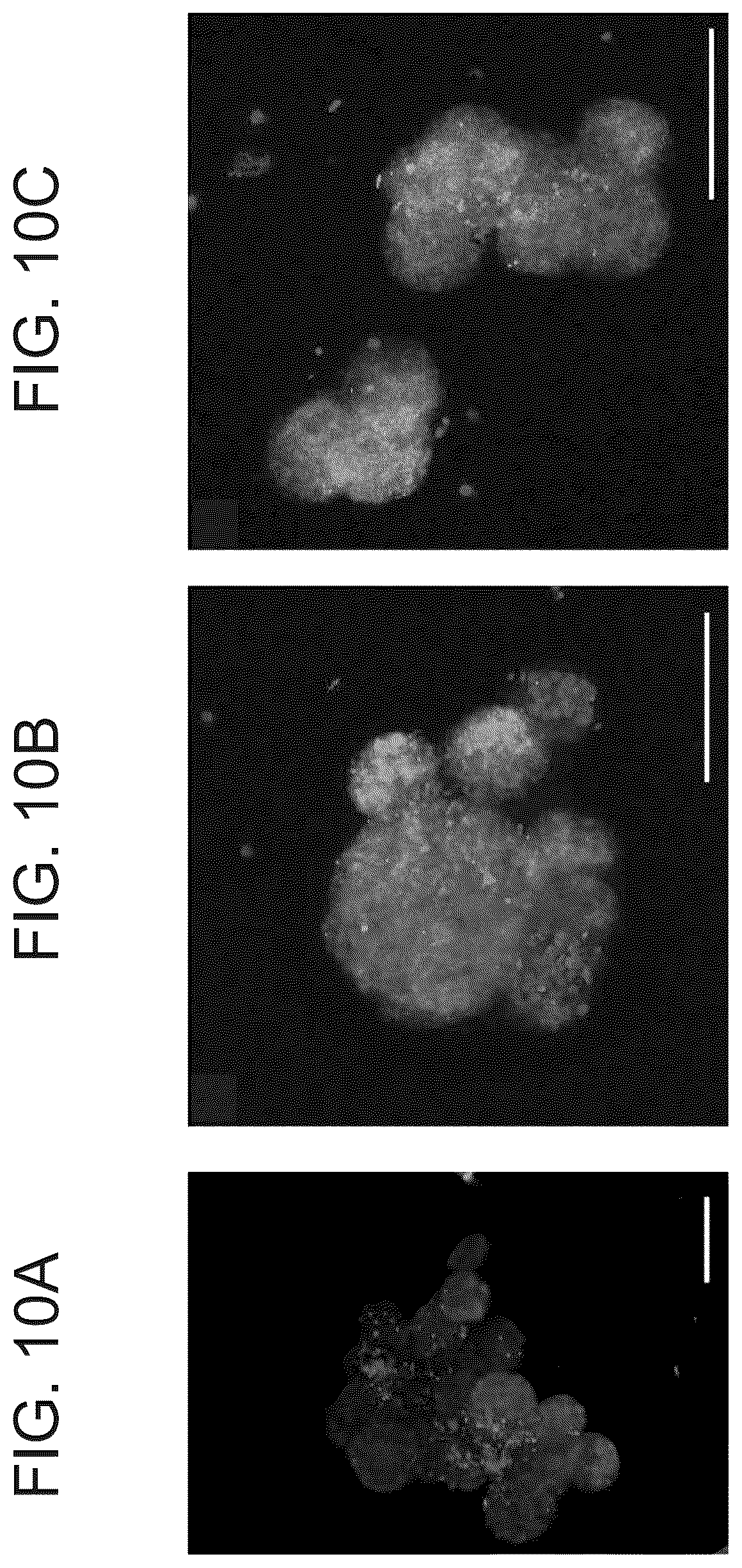 Patent US12311075 Figure 10 – Particles comprising decellularized omentum