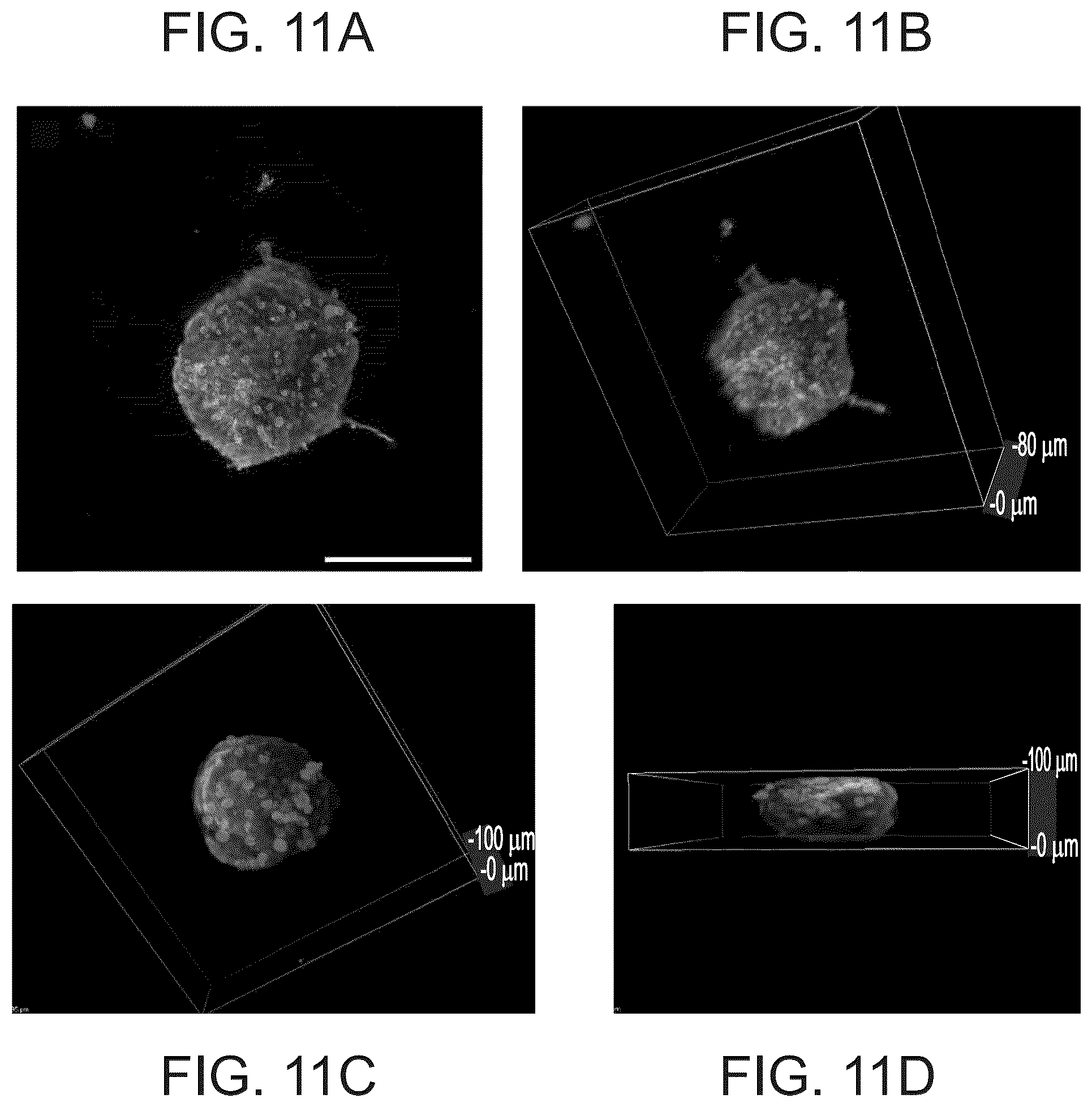 Patent US12311075 Figure 11 – Particles comprising decellularized omentum