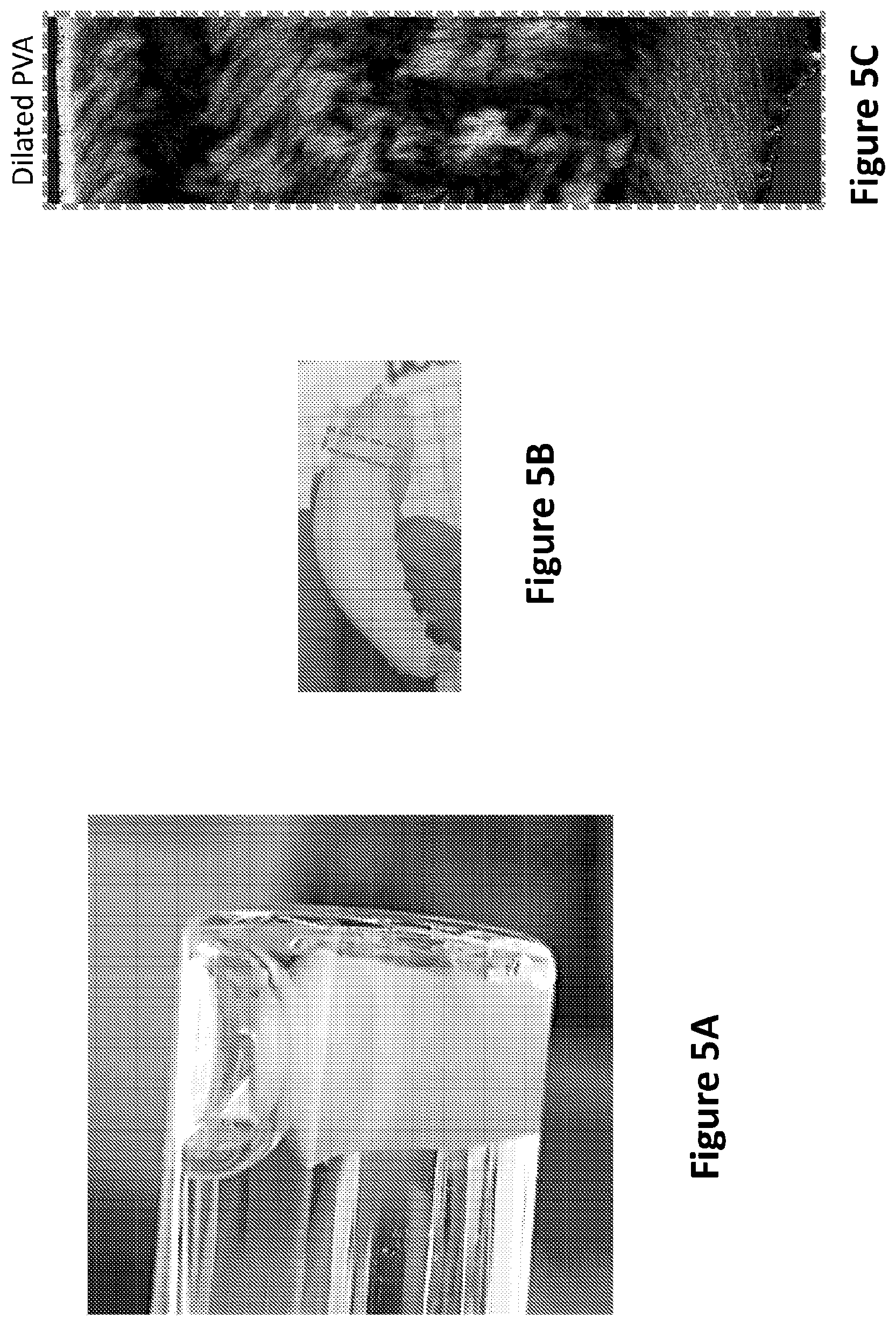 Patent US12311077 Figure 5 – Method of making, manufacturing or producing orthopedic soft tissue