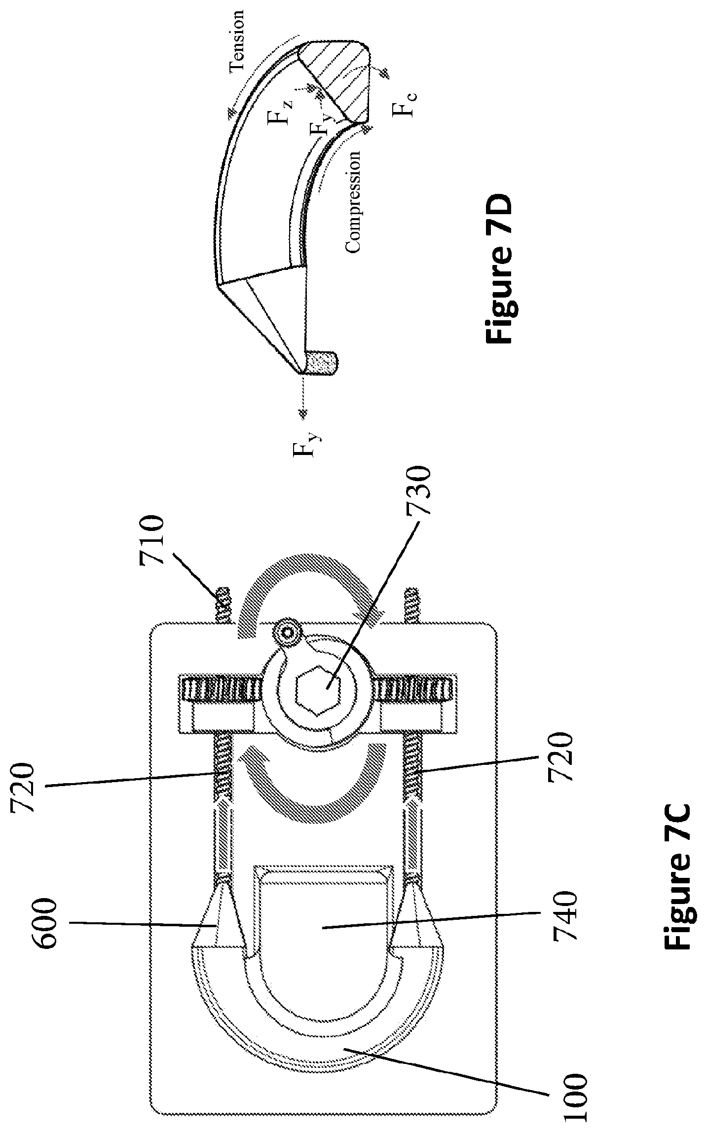 Patent US12311077 Figure 9 – Method of making, manufacturing or producing orthopedic soft tissue