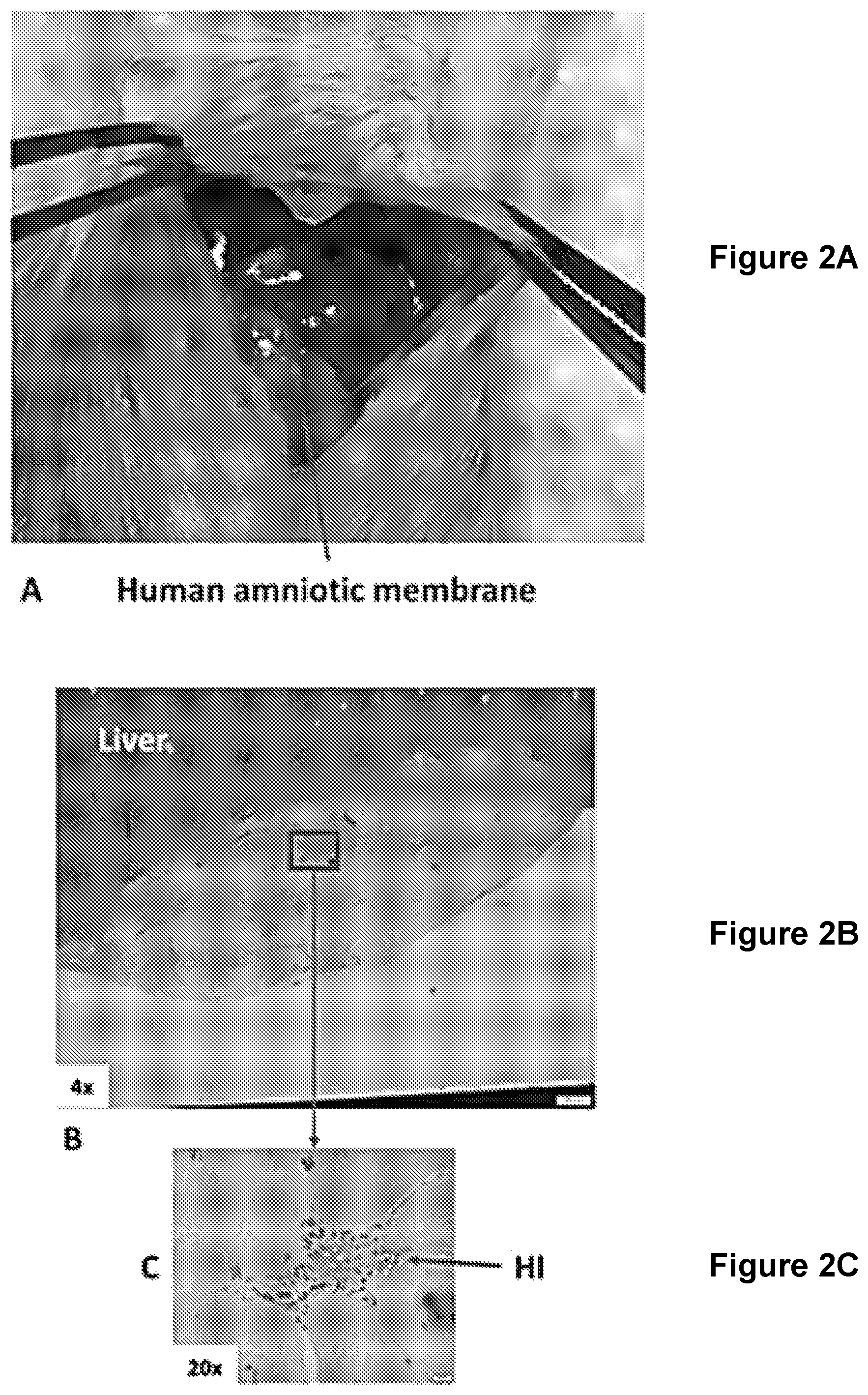 Patent US12311078 Figure 2 – Methods and compositions for cell transplantation